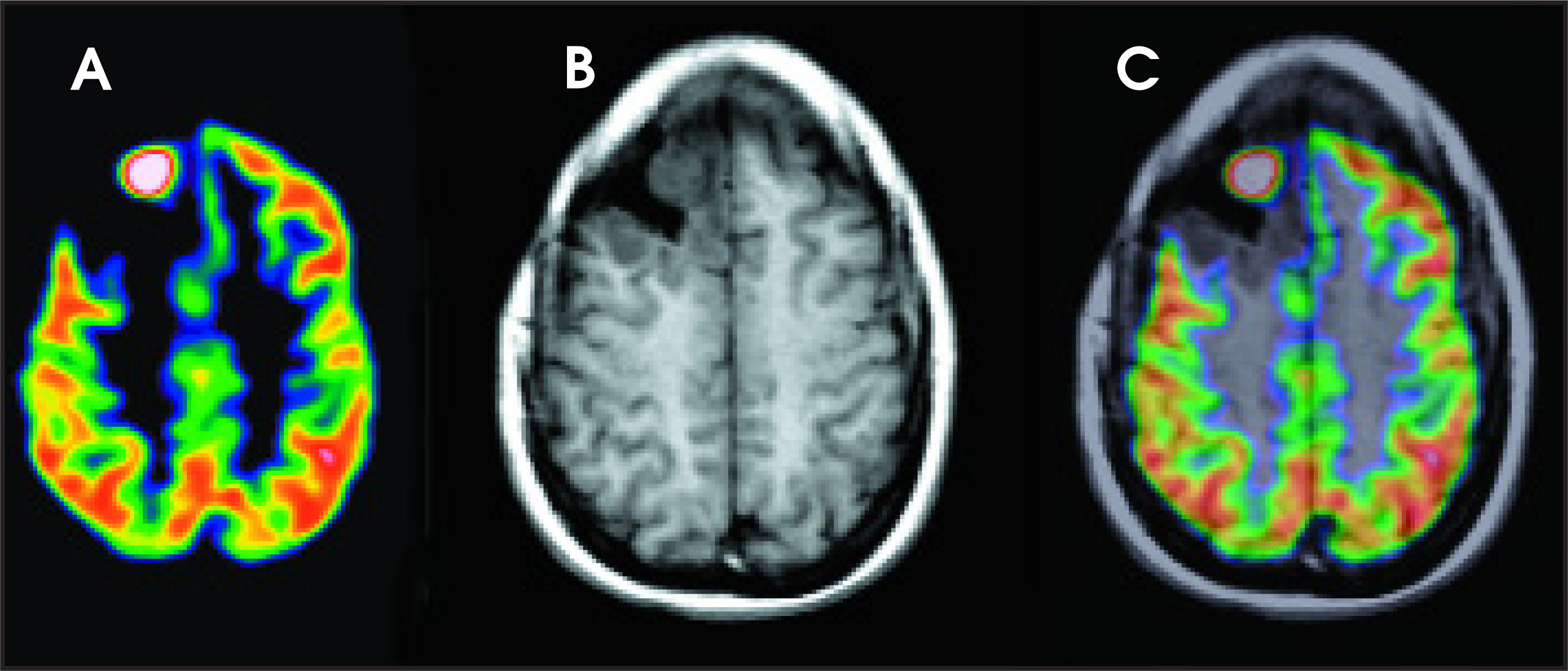 FIGURE 6.