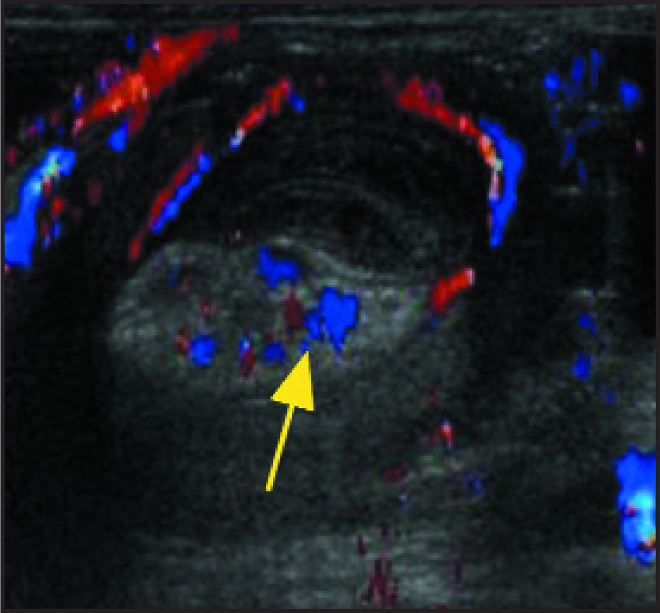 FIGURE 6.