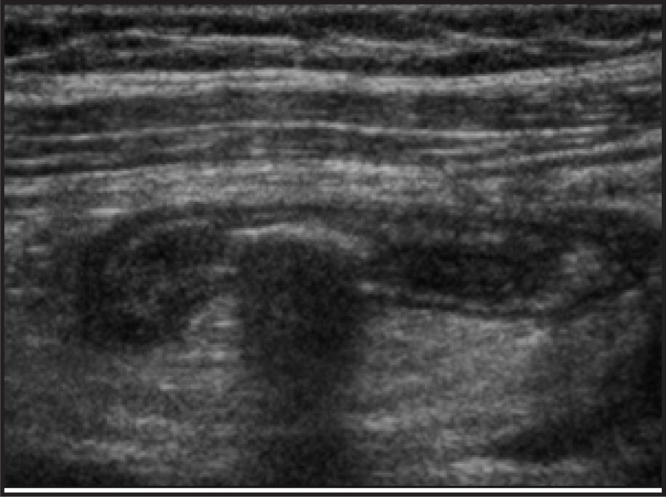 FIGURE 11.