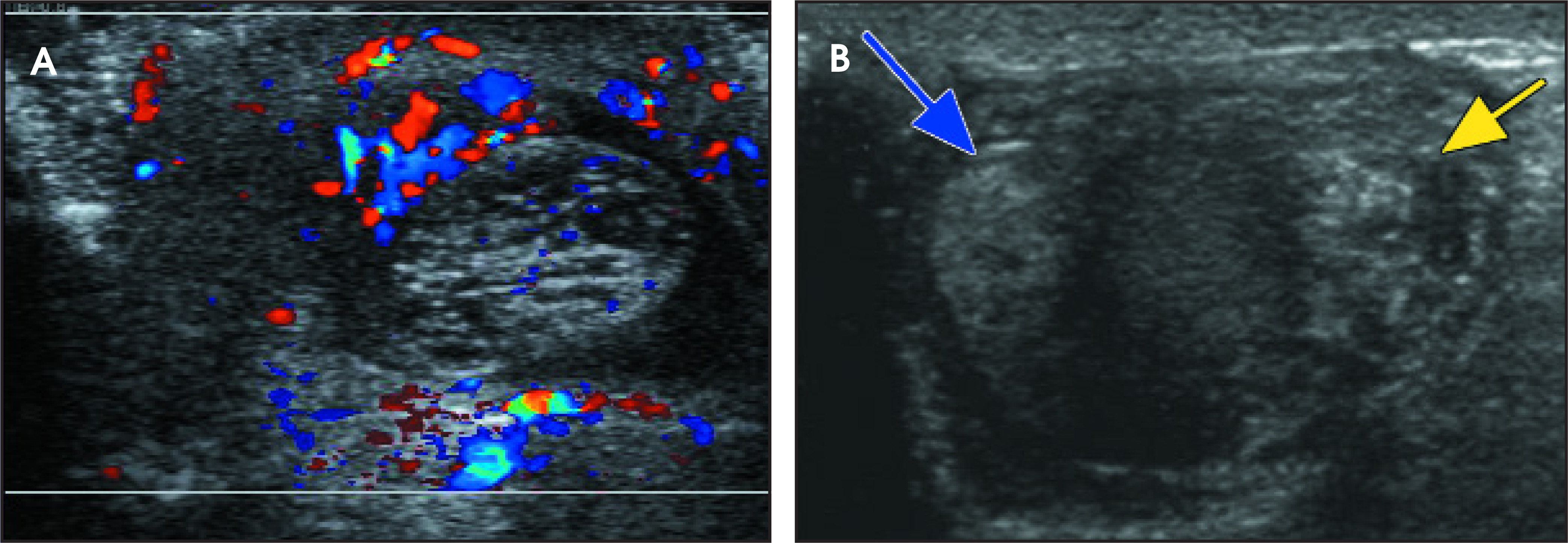 FIGURE 13.