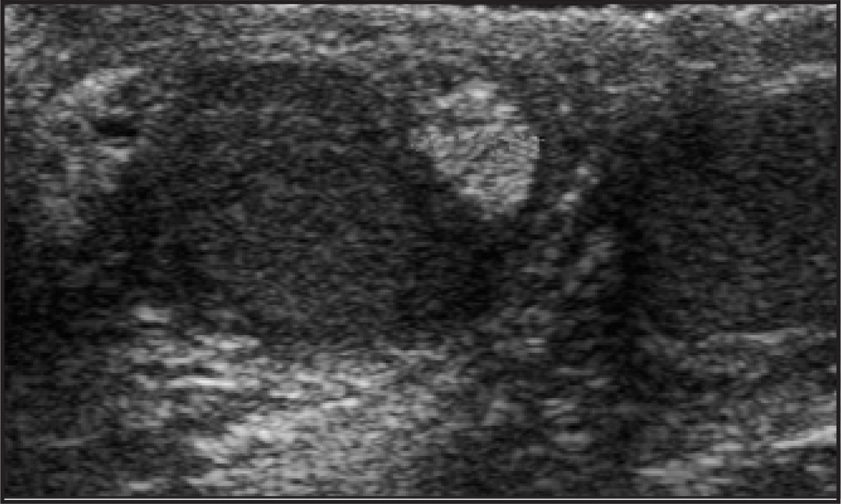 FIGURE 14.