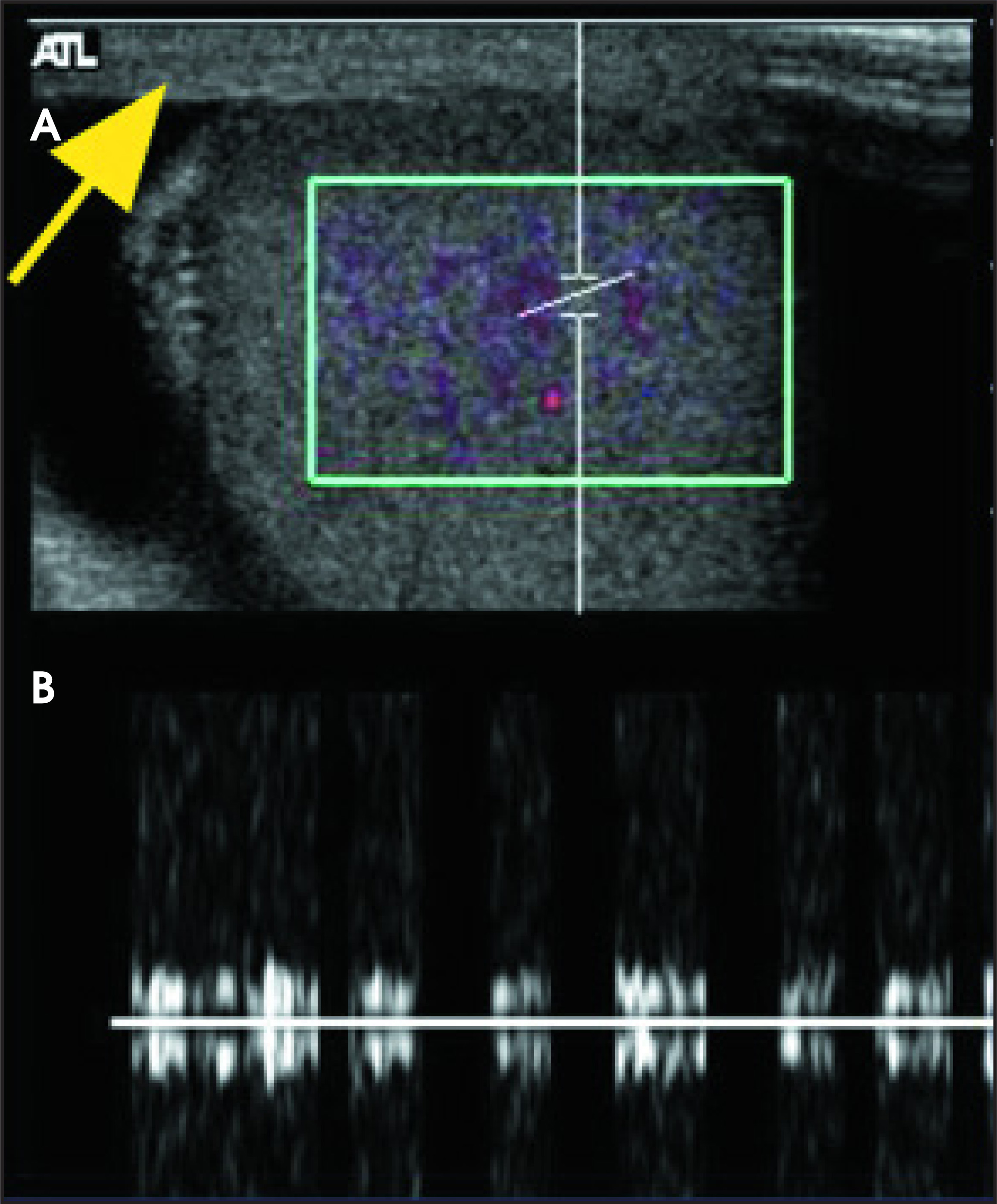 FIGURE 17.