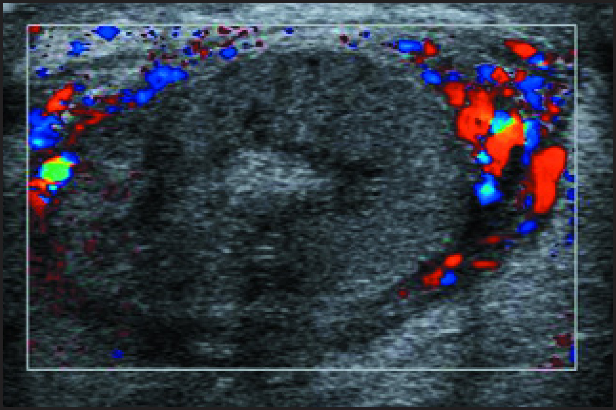 FIGURE 18.