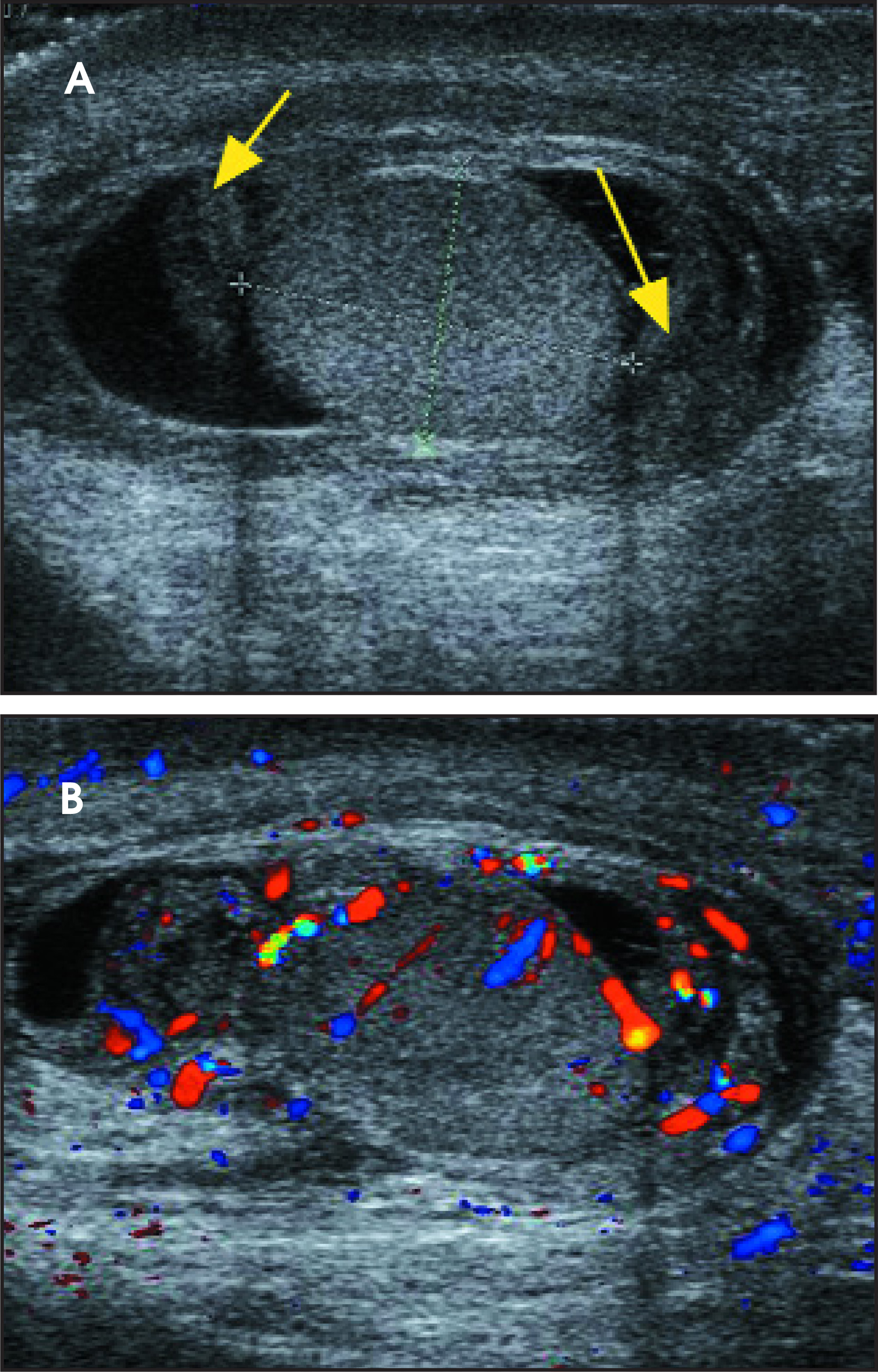 FIGURE 20.