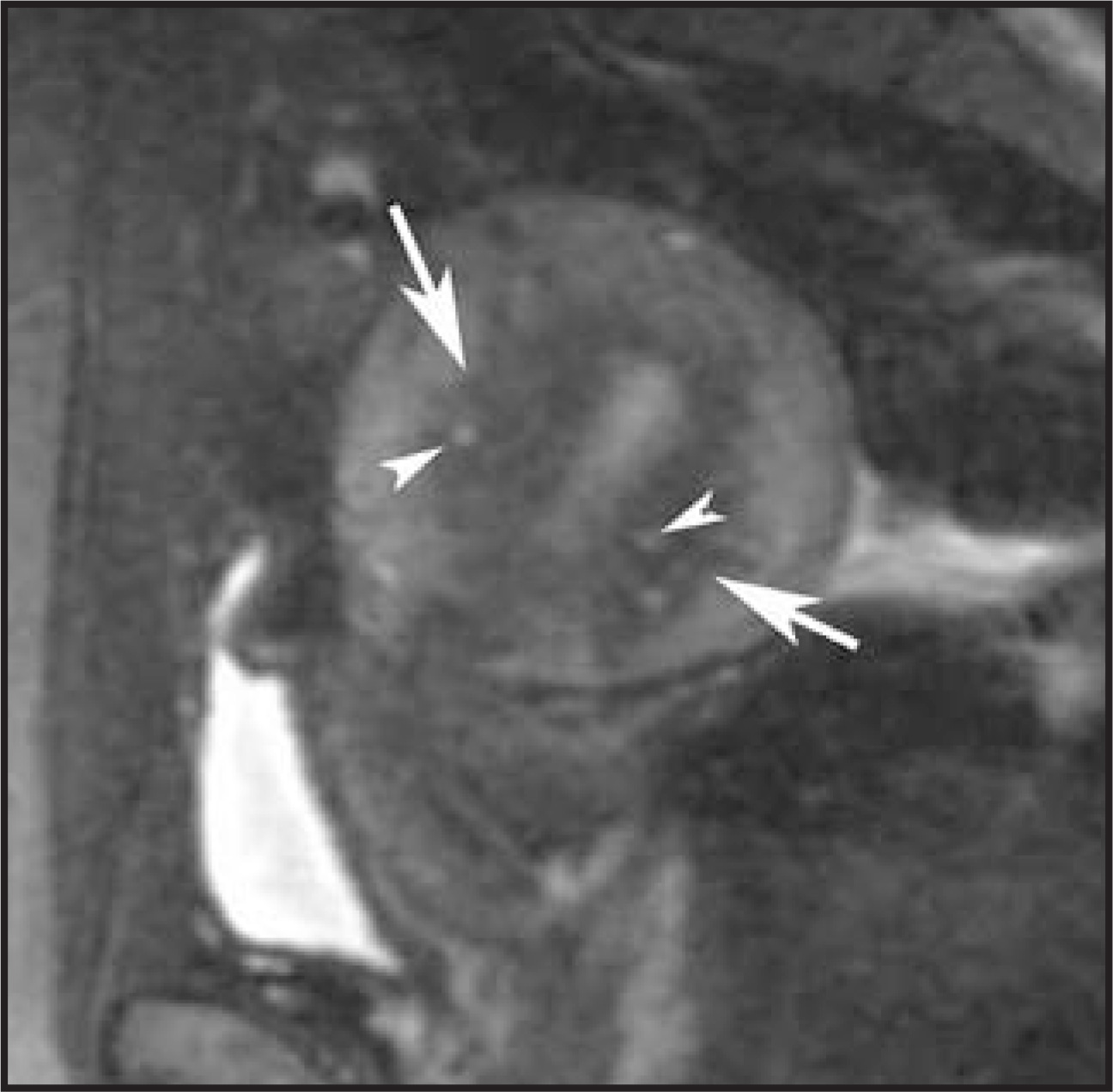 FIGURE 11.