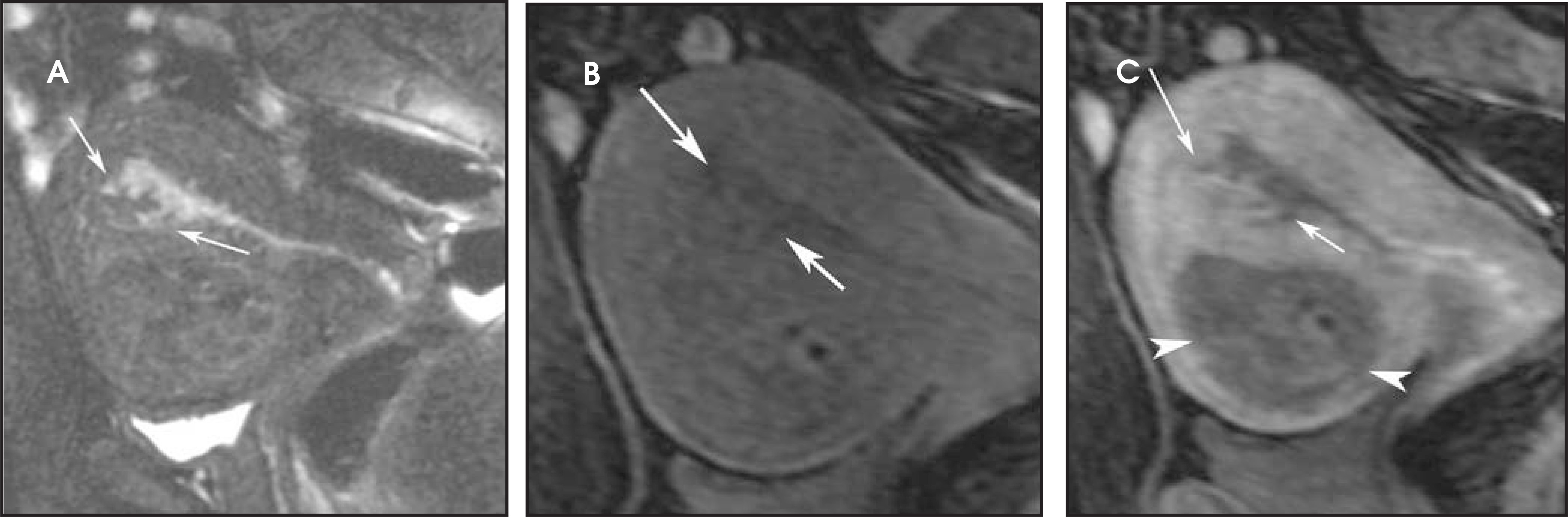 FIGURE 13.