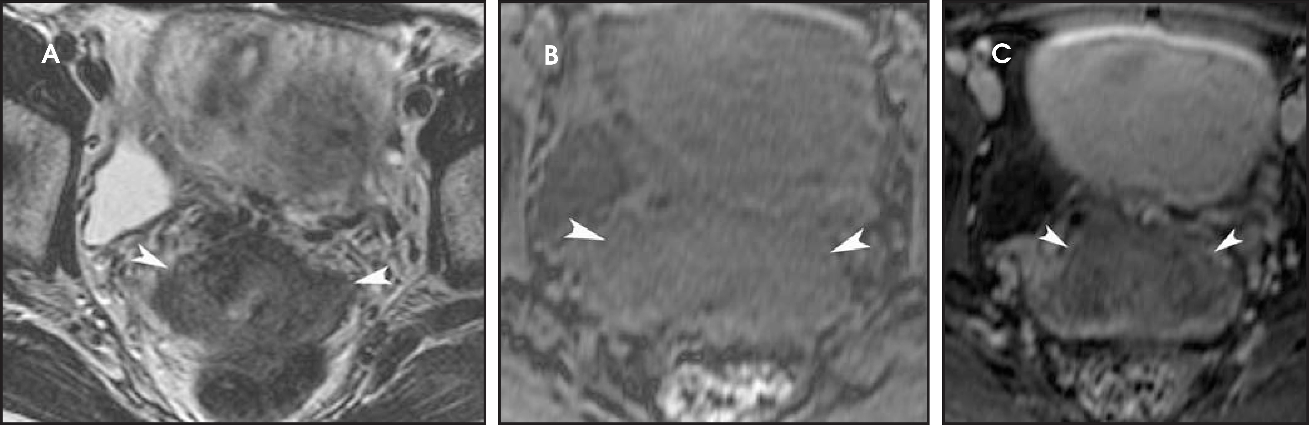 FIGURE 14.