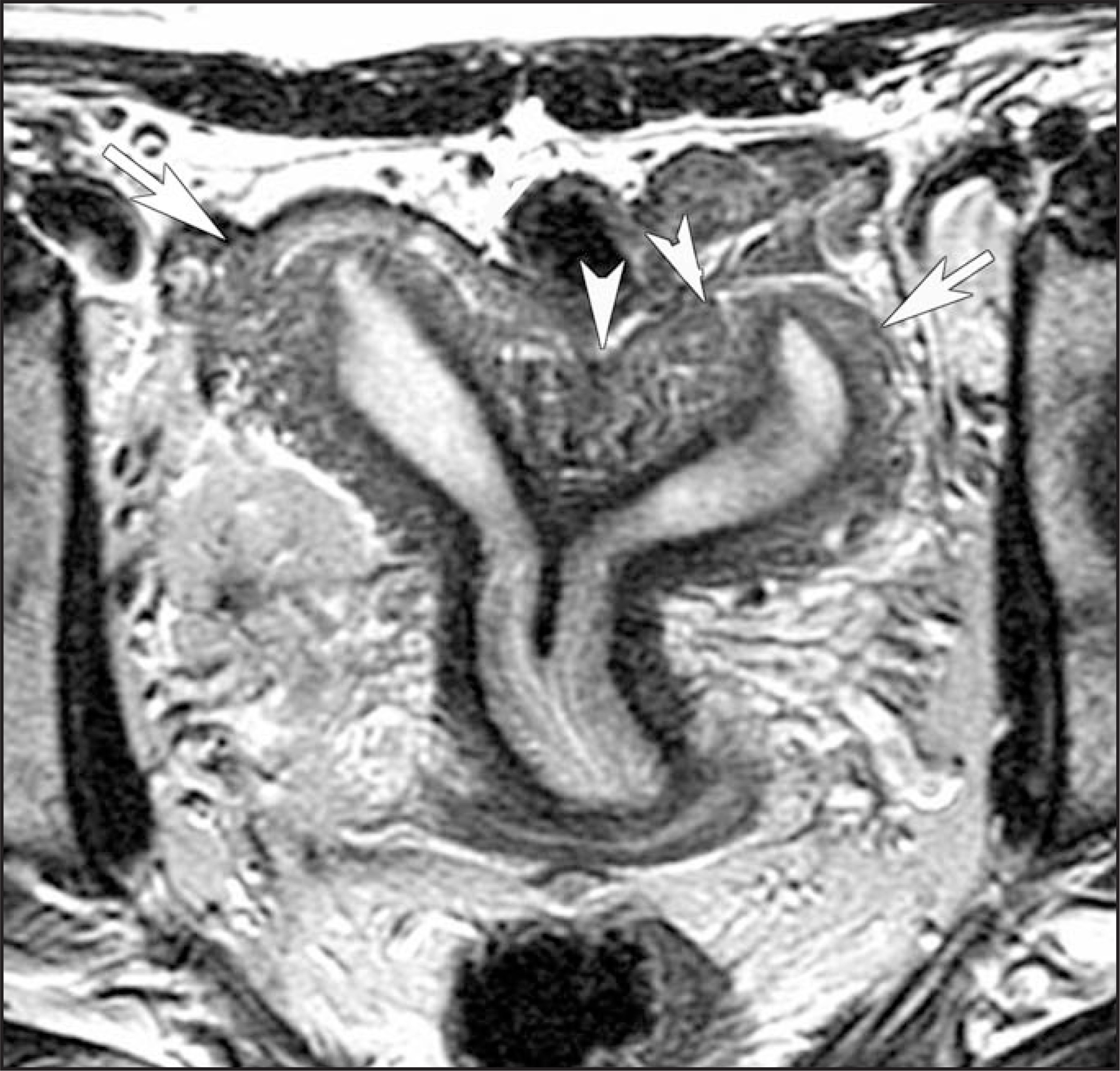 FIGURE 16.