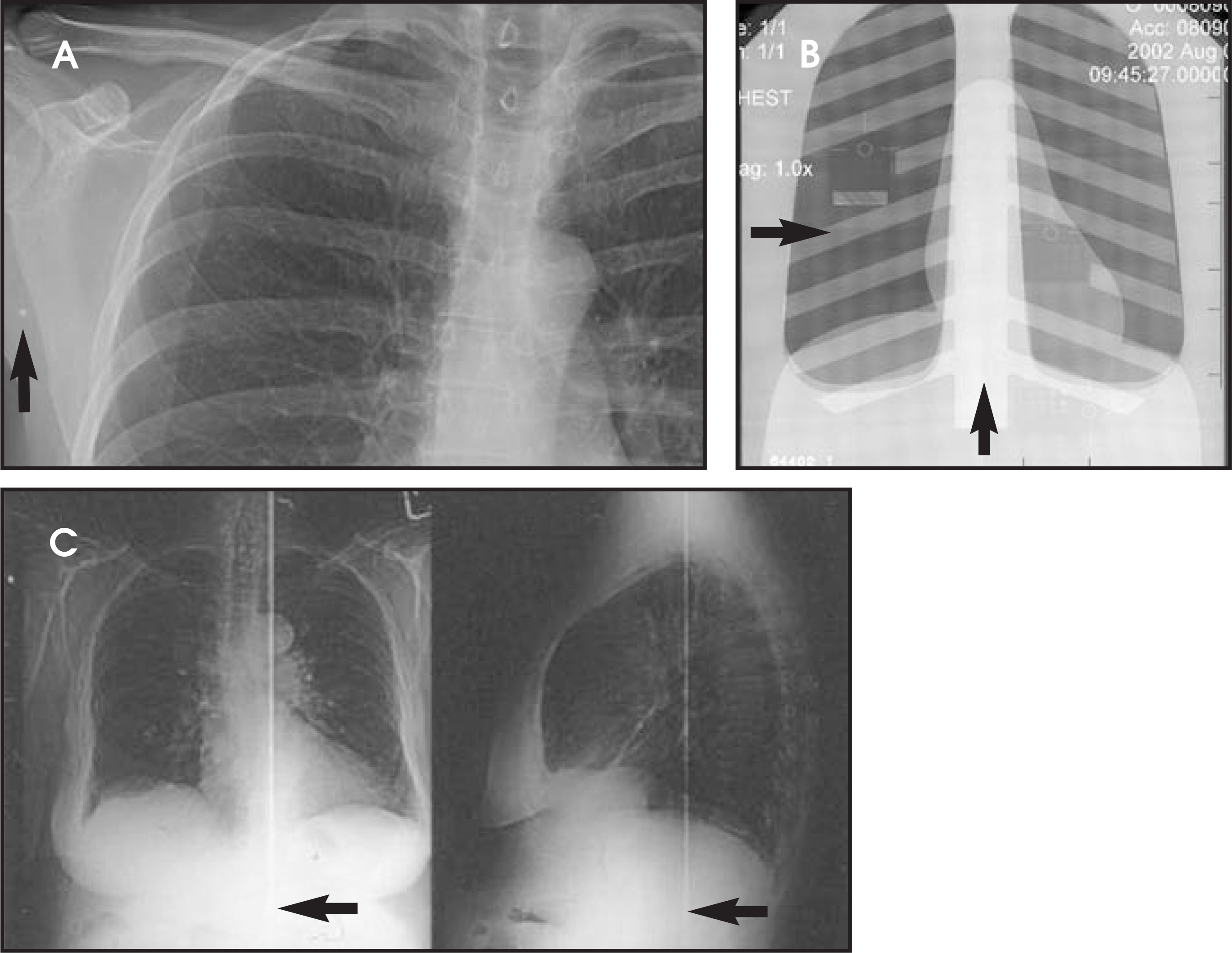 FIGURE 3.