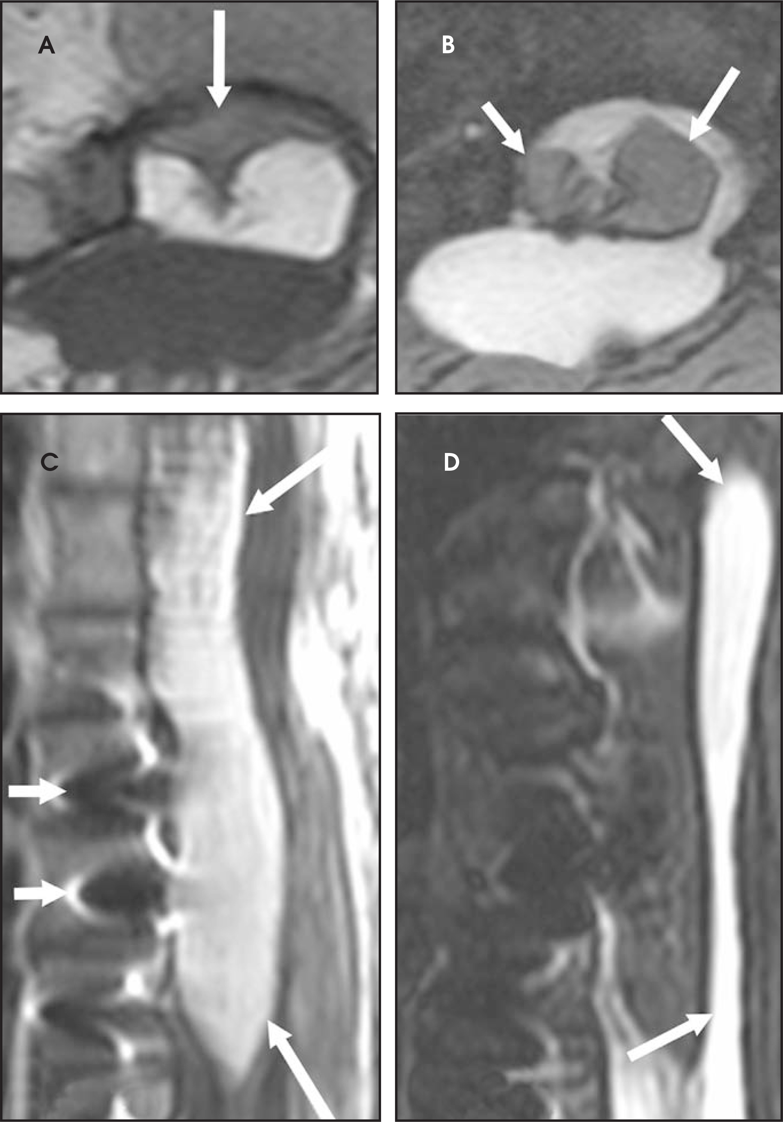 FIGURE 11.