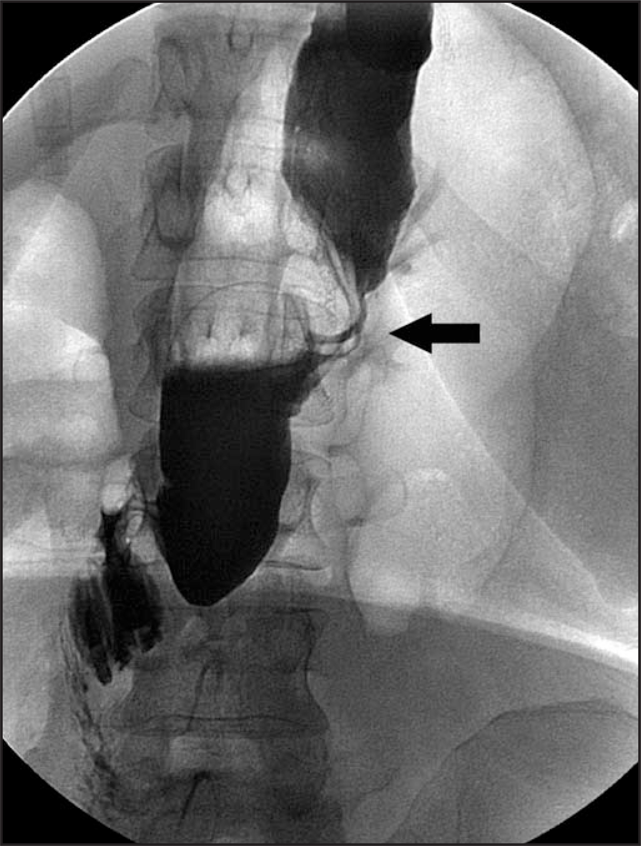 FIGURE 11.