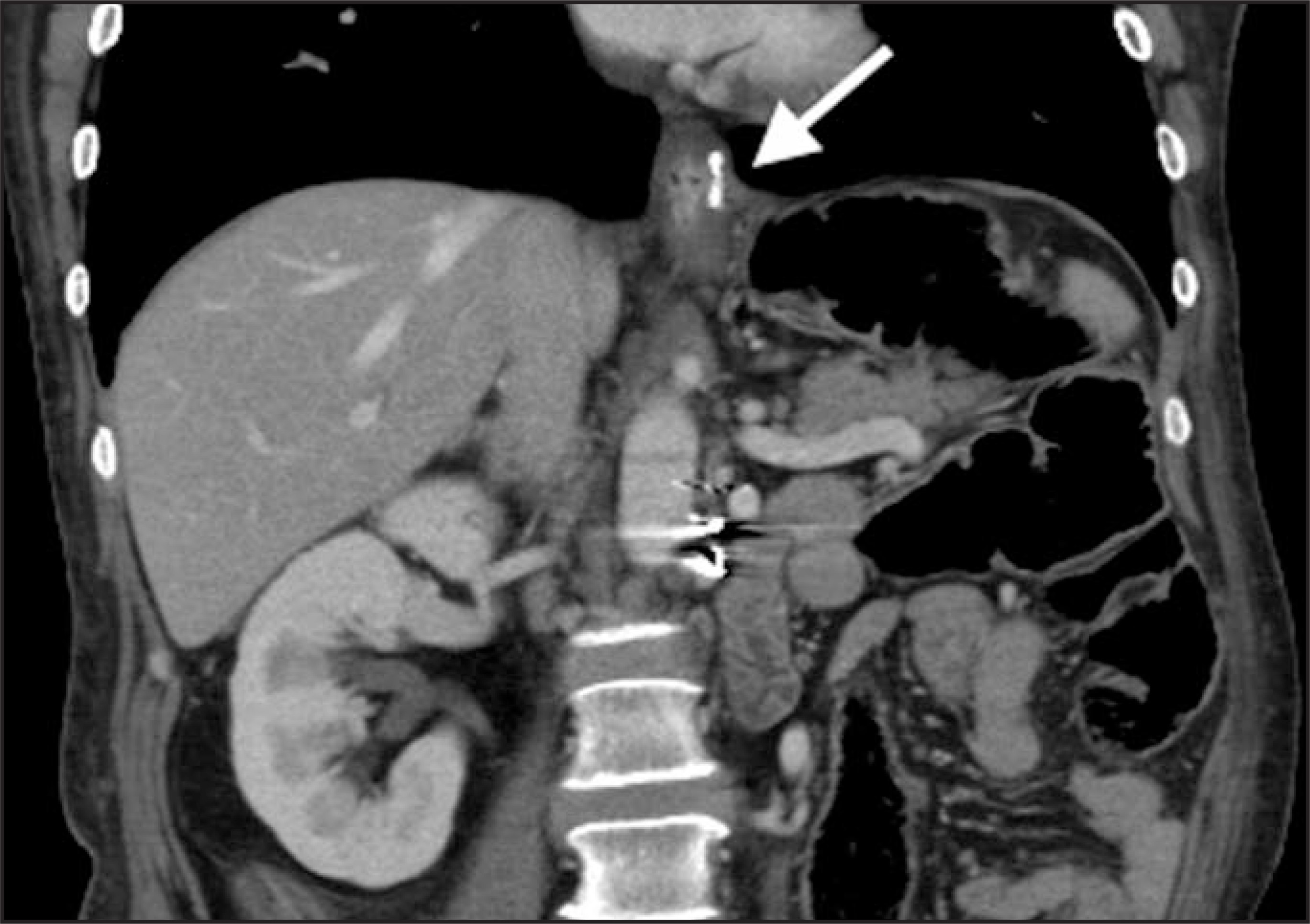 FIGURE 13.