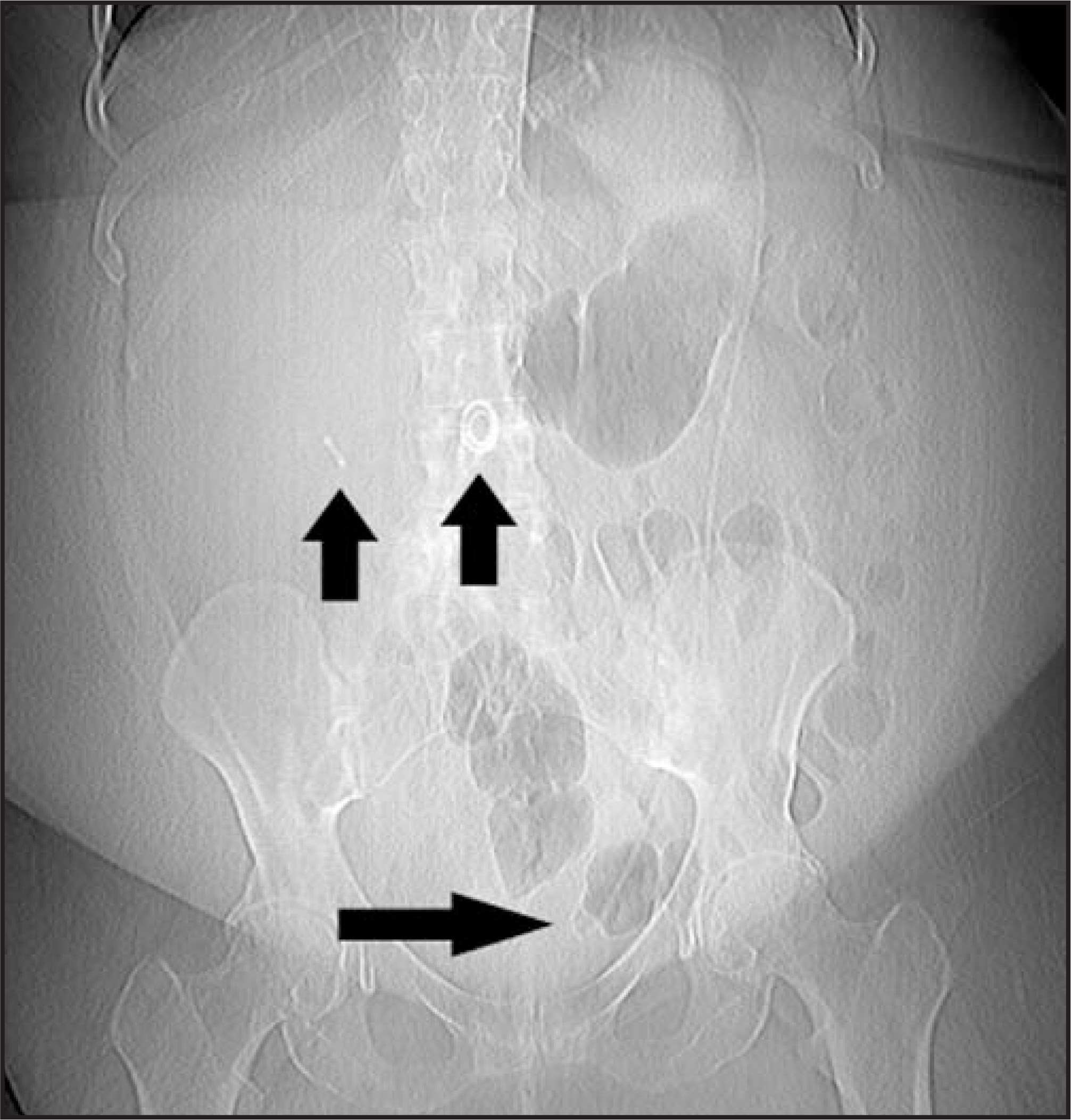 FIGURE 18.