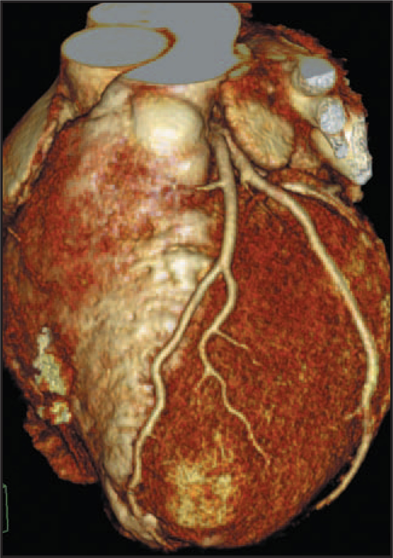 FIGURE 4.