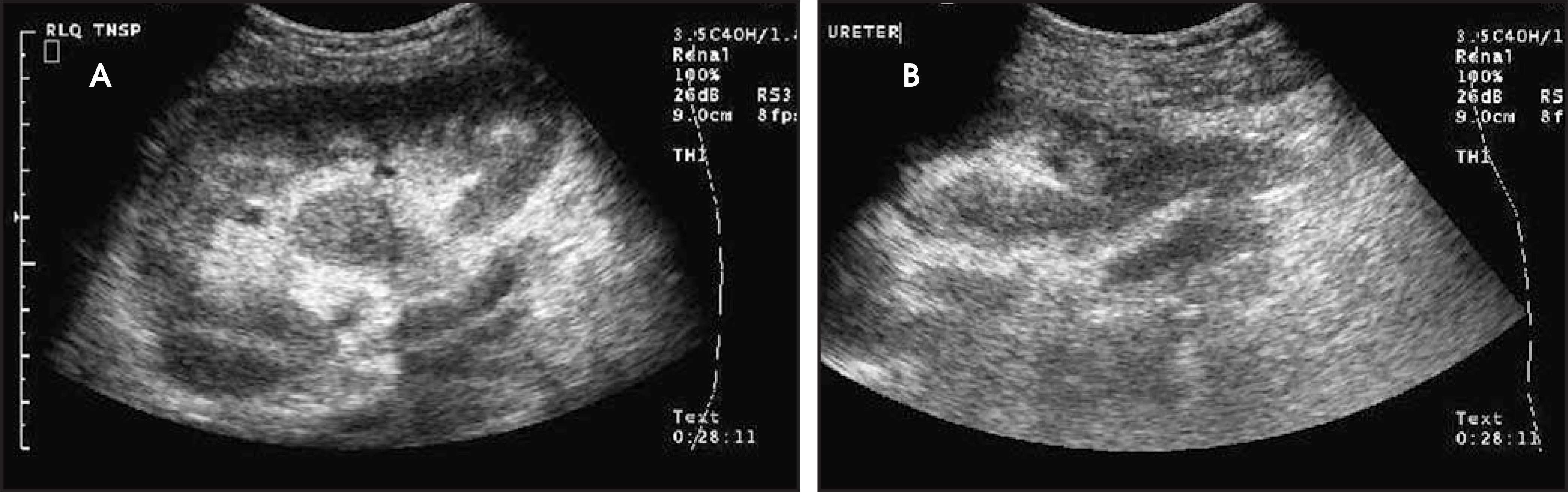 FIGURE 11.