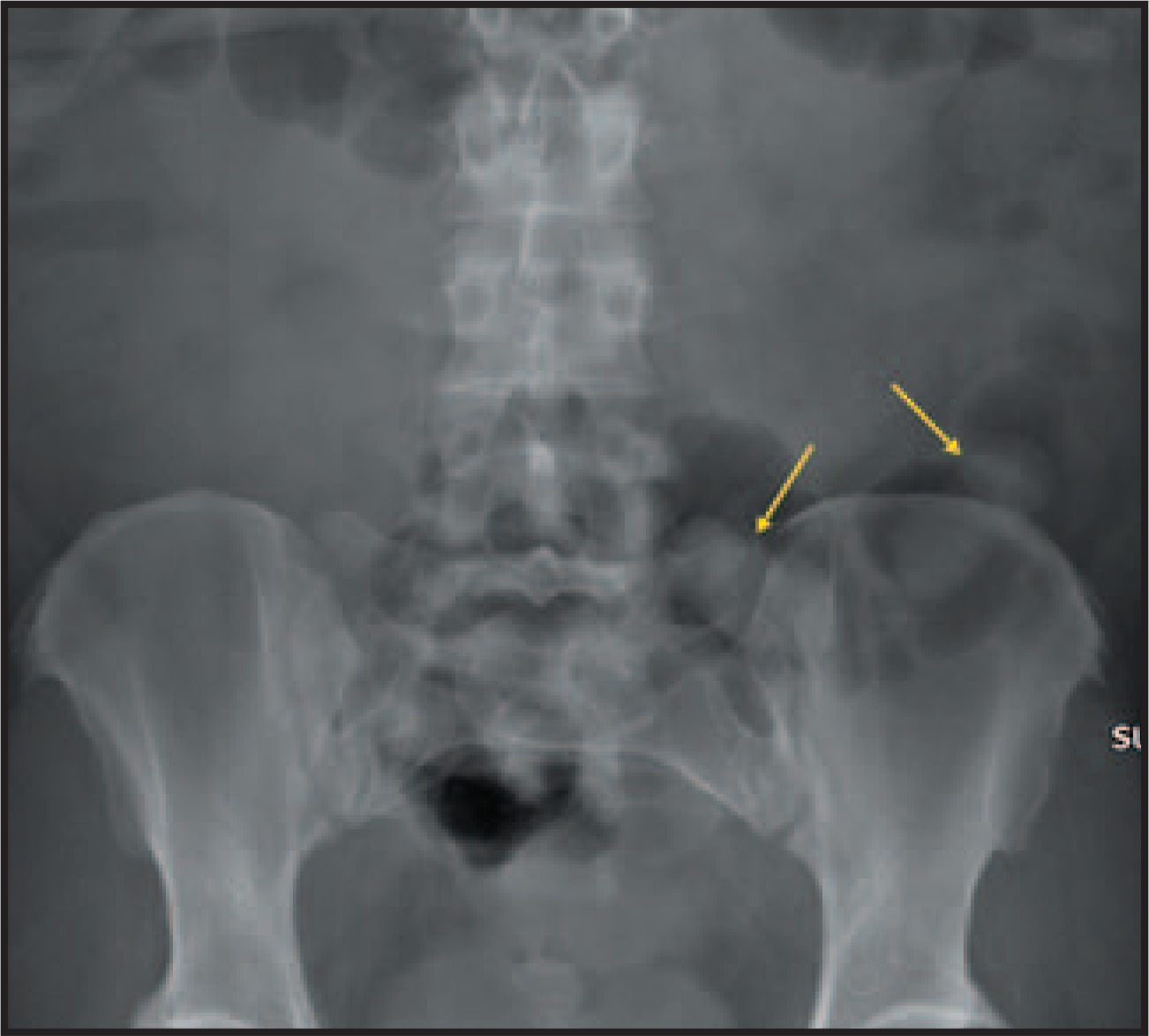 FIGURE 2.