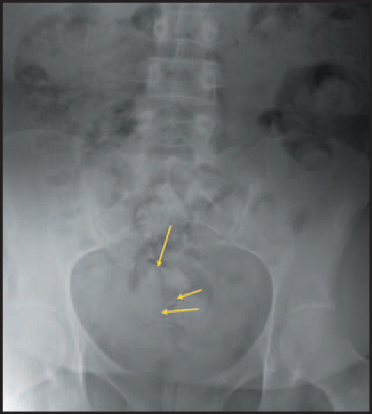 FIGURE 5.