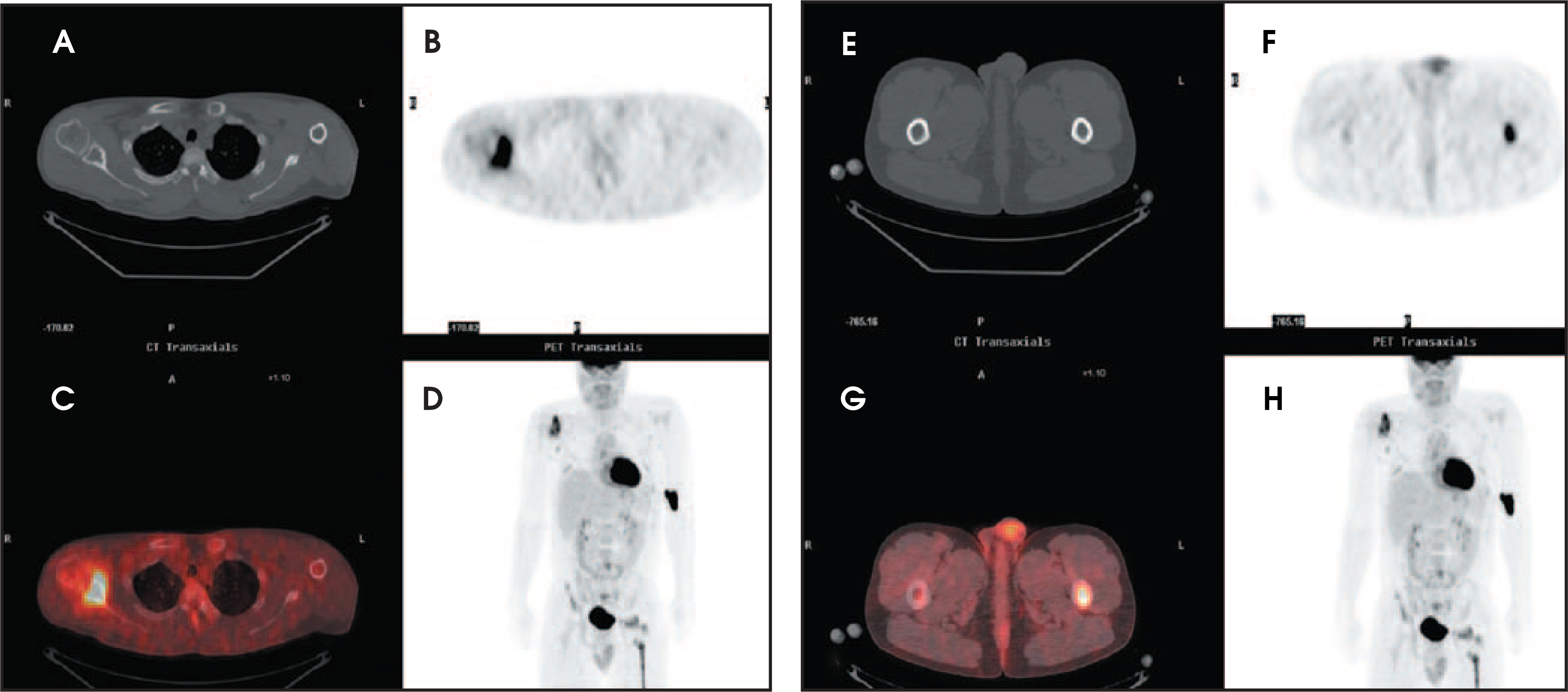 FIGURE 11.
