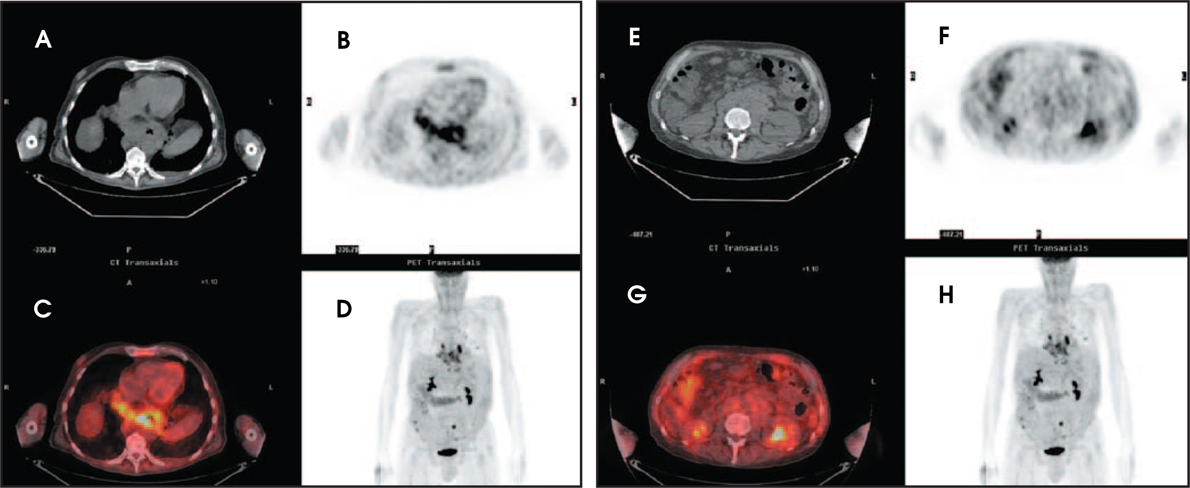 FIGURE 13.
