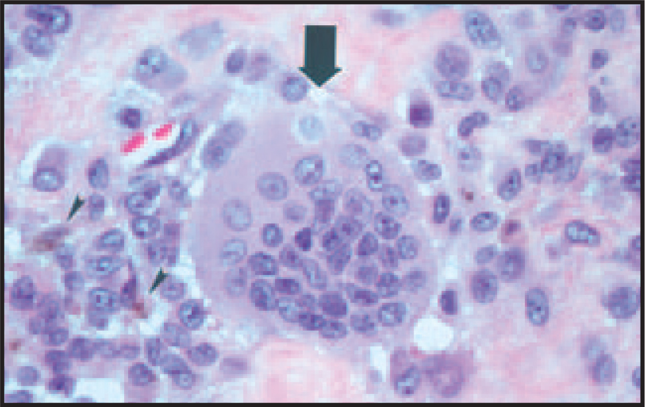 FIGURE 4.