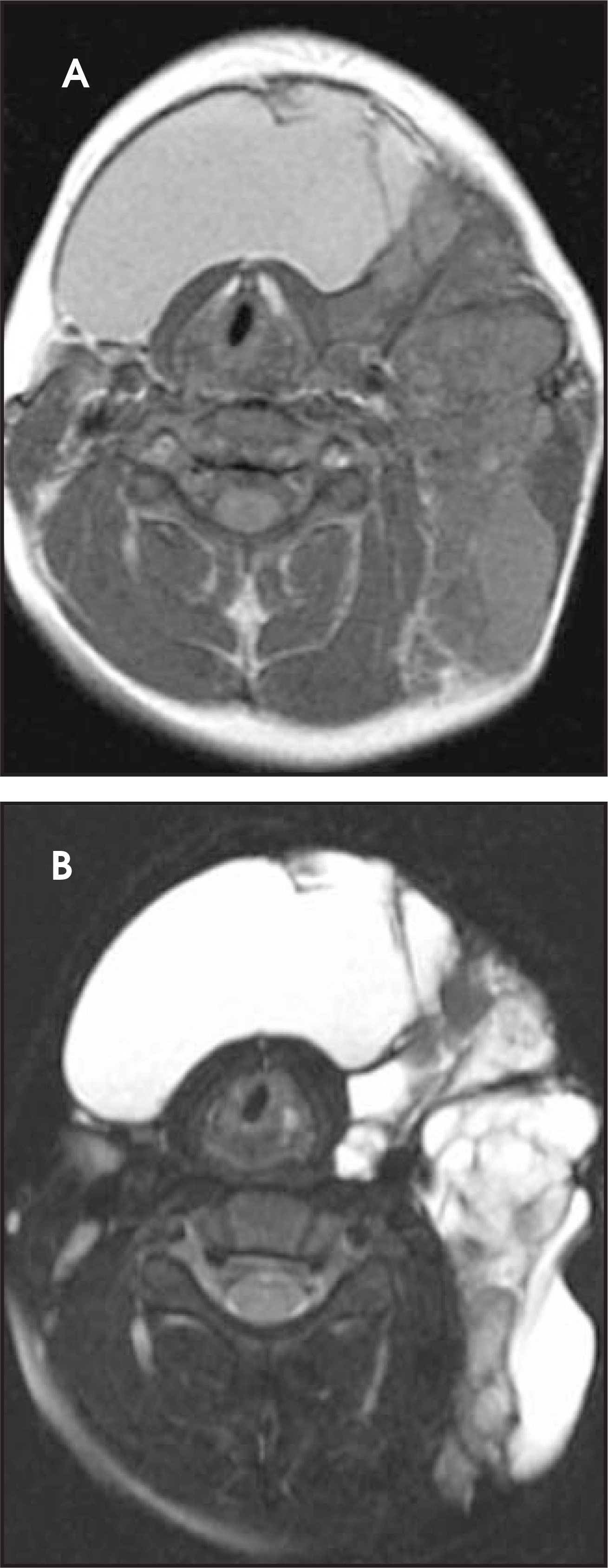 FIGURE 11.