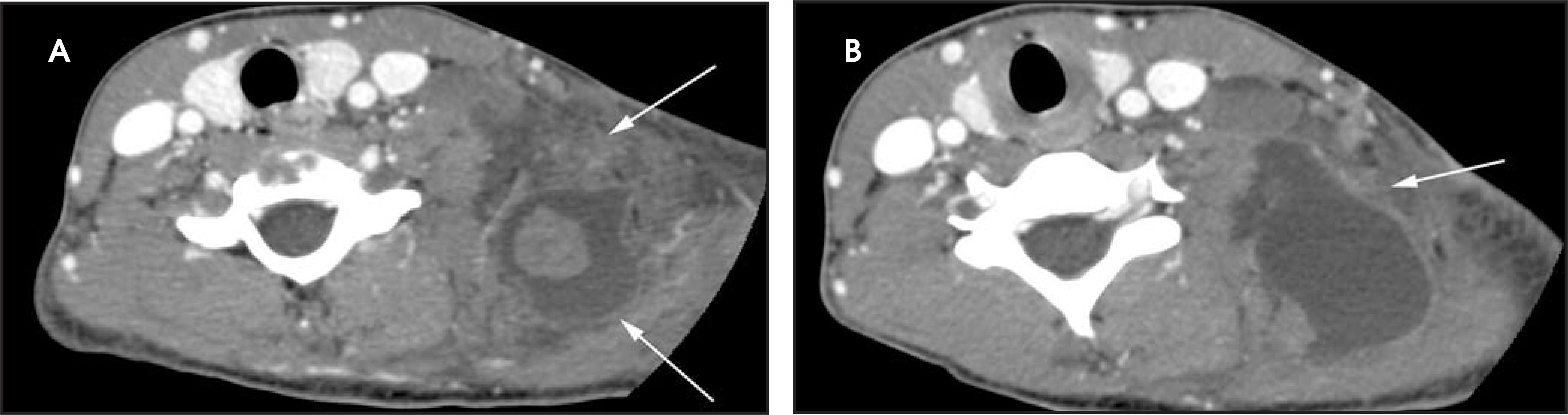 FIGURE 12.