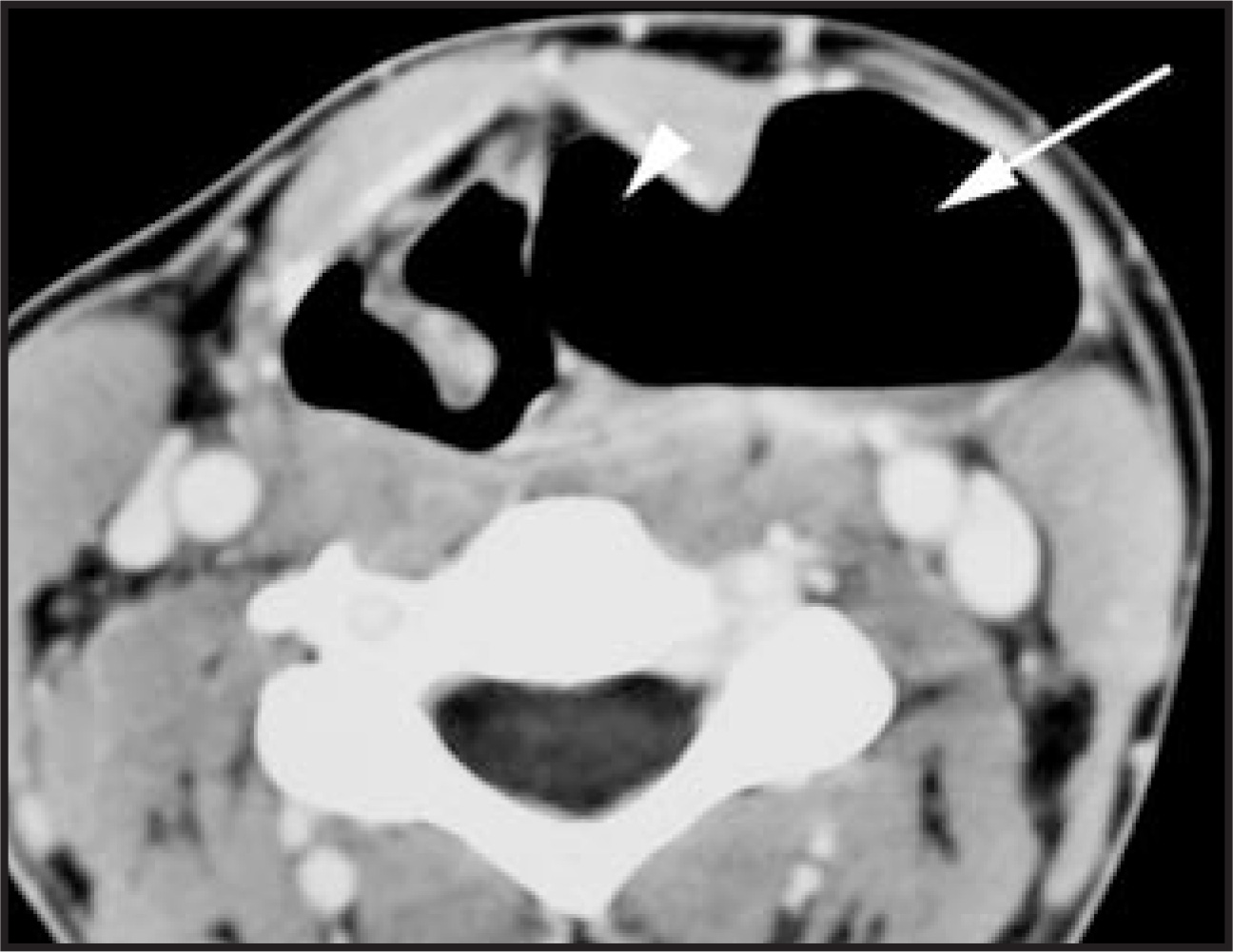 FIGURE 14.