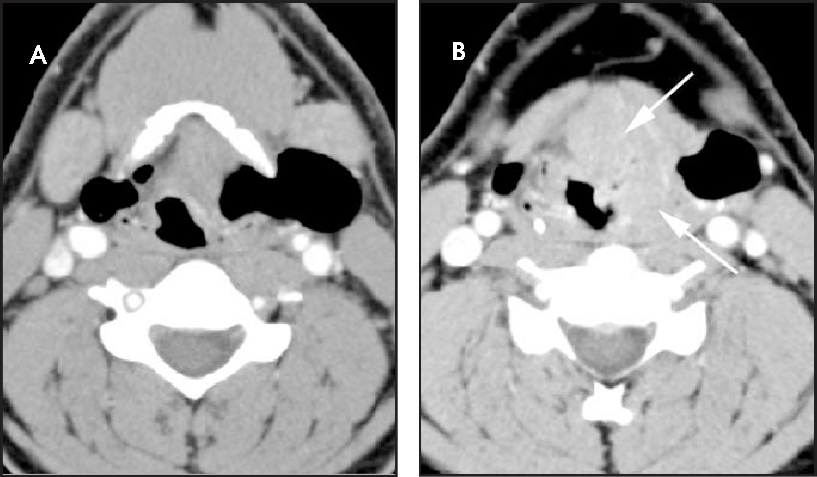 FIGURE 15.
