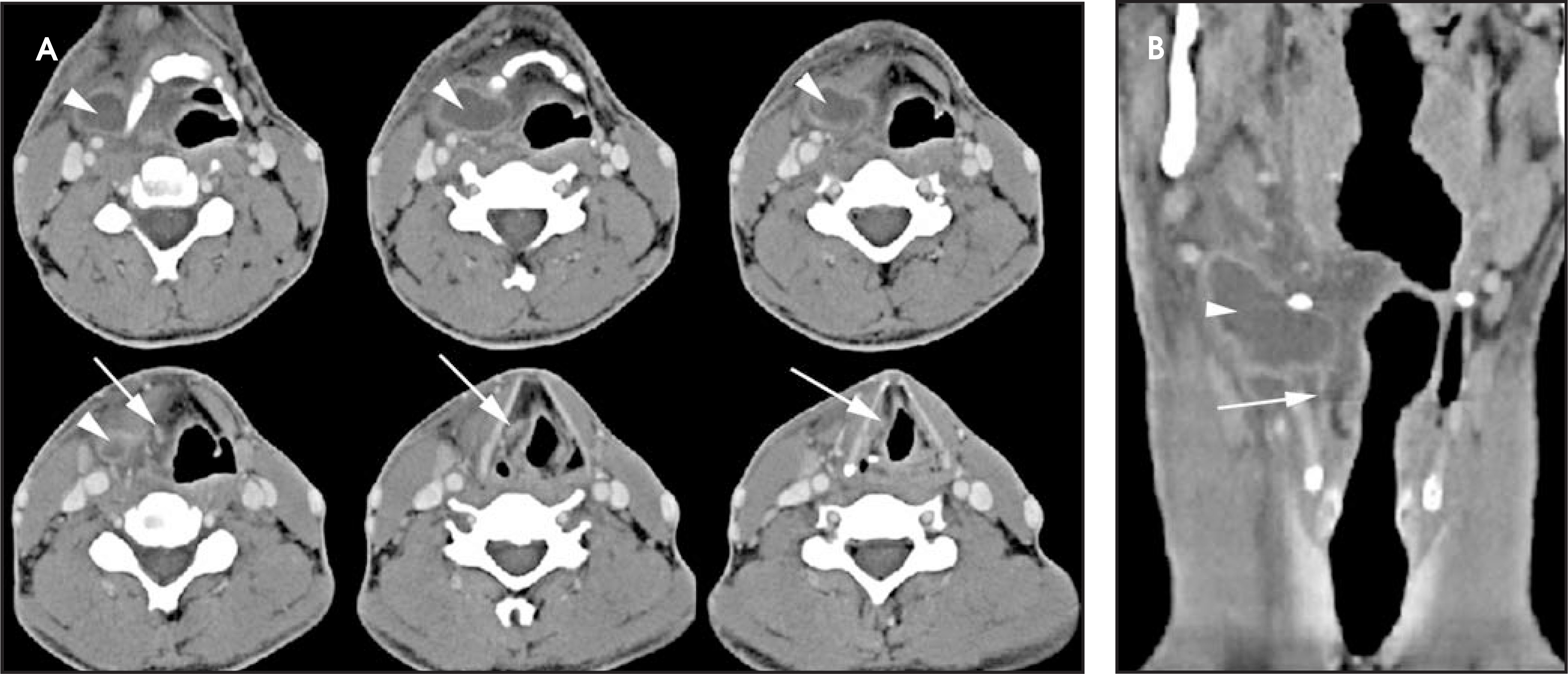 FIGURE 16.