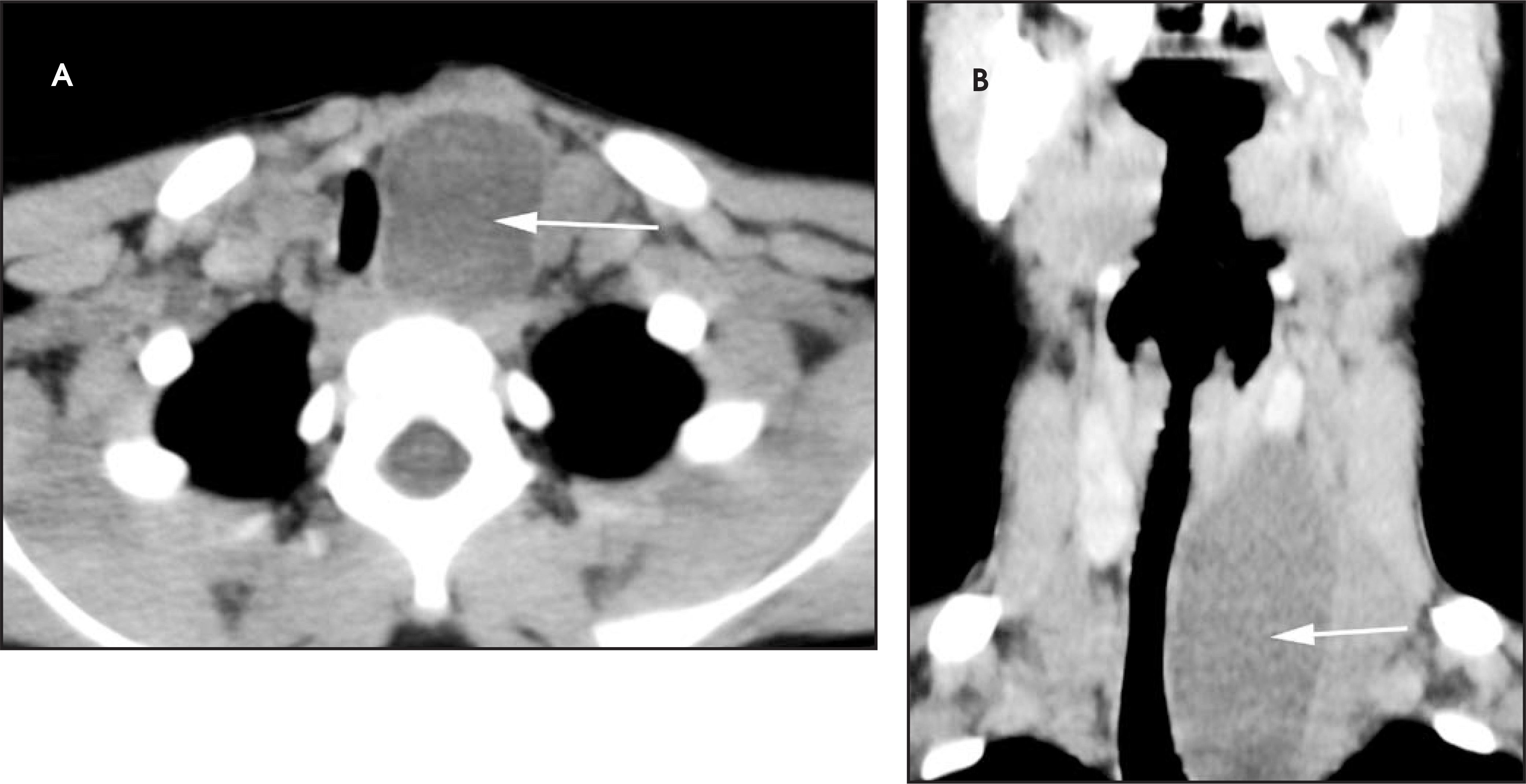 FIGURE 17.
