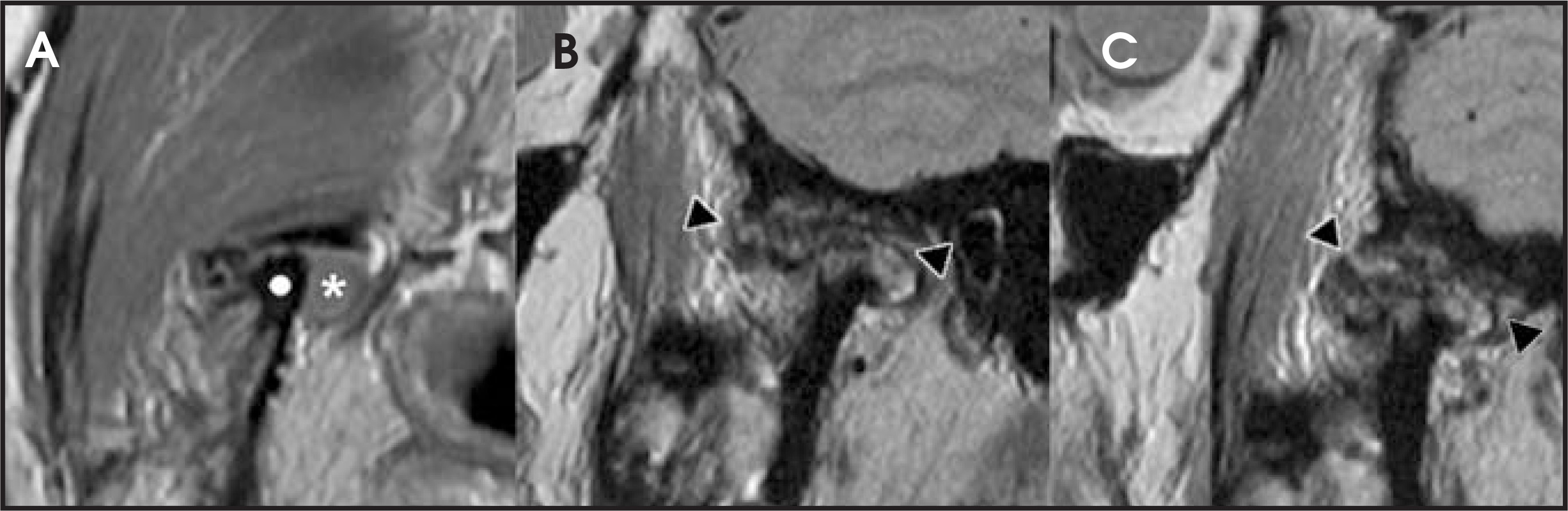 FIGURE 11.