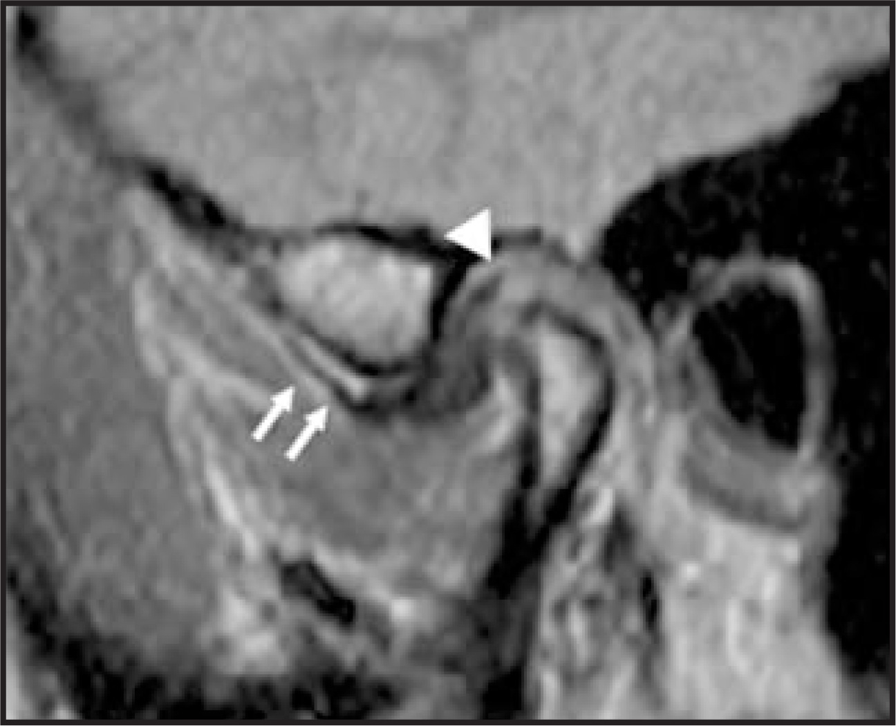 FIGURE 12.