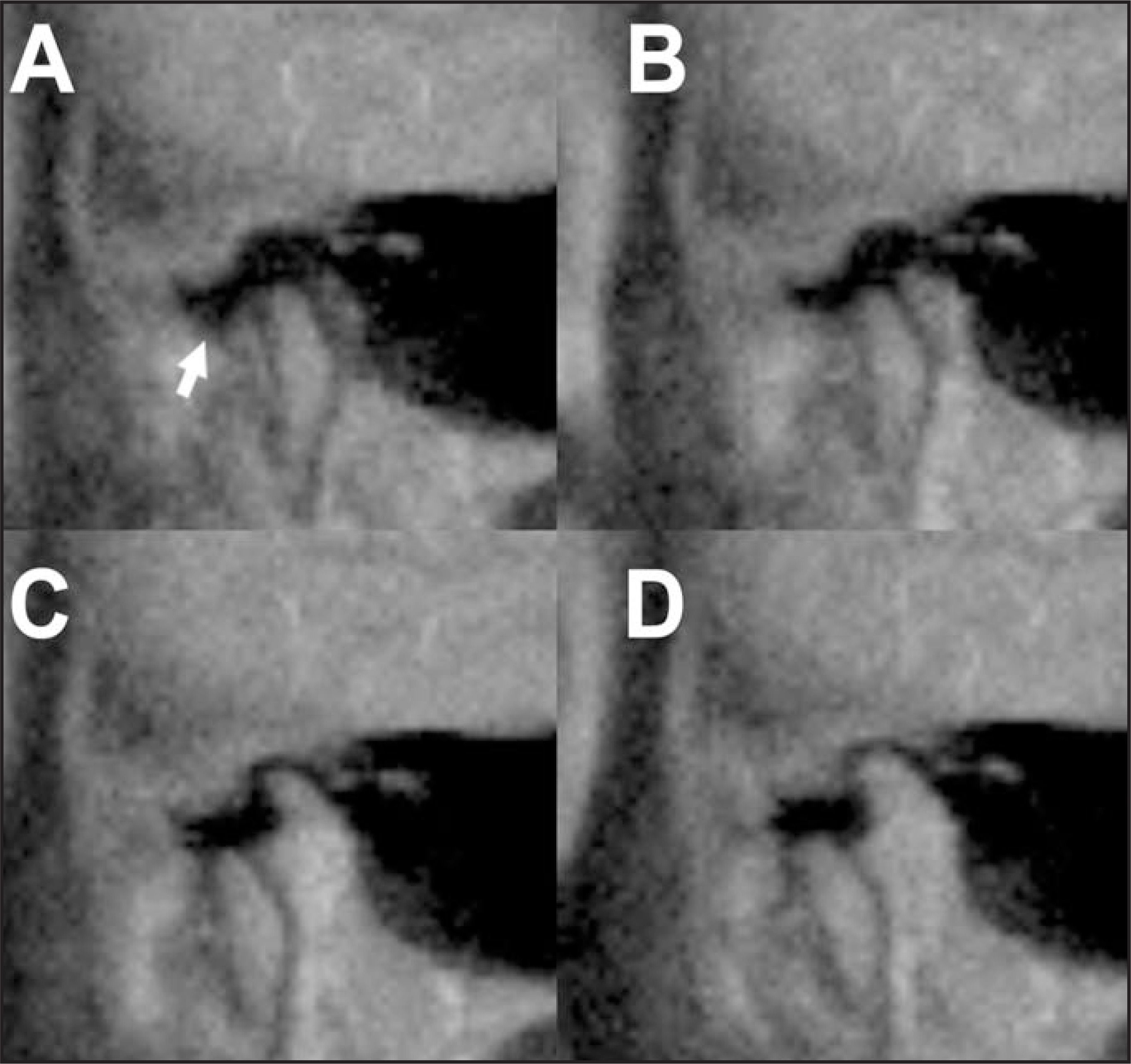 FIGURE 14.