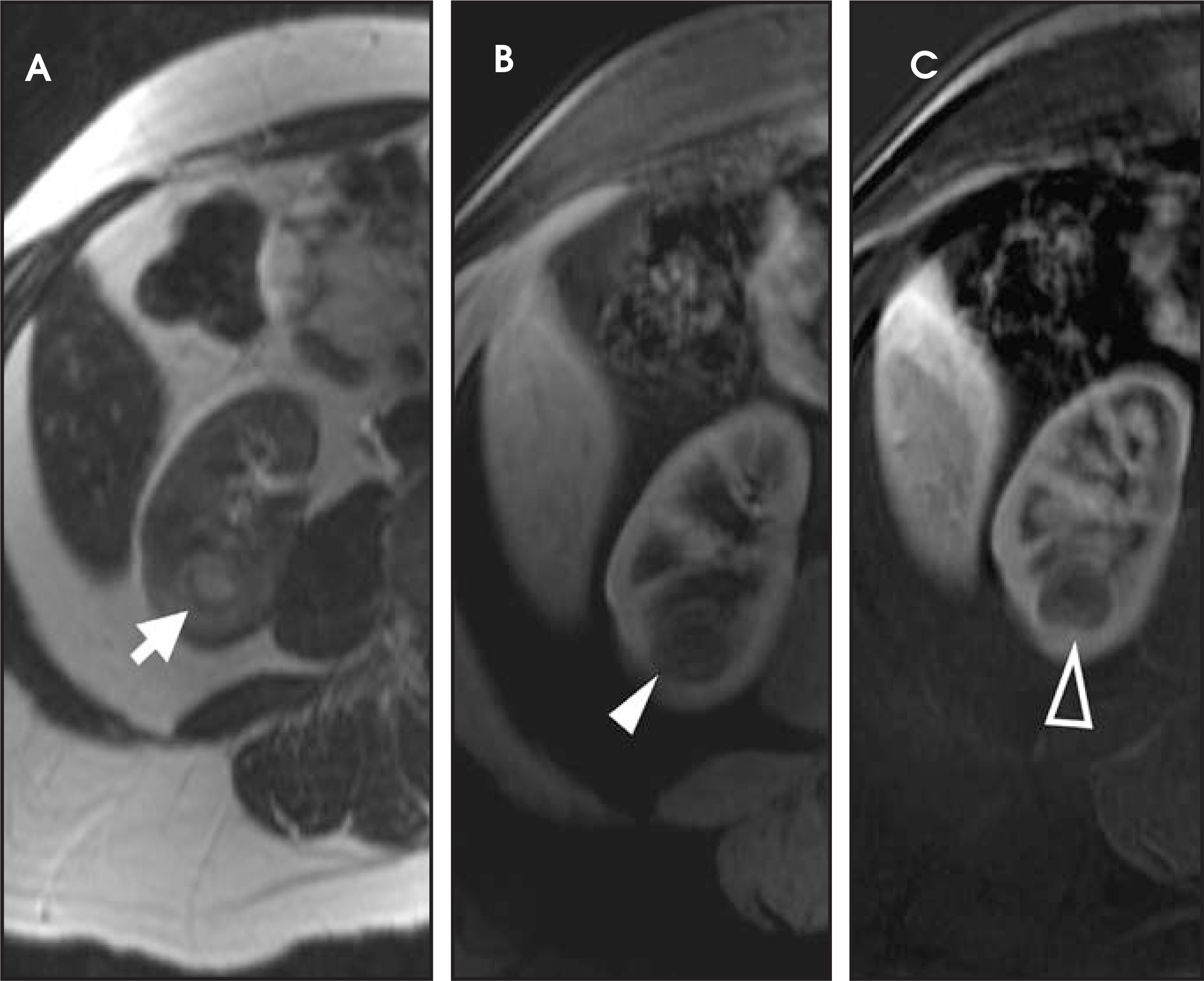 FIGURE 11.