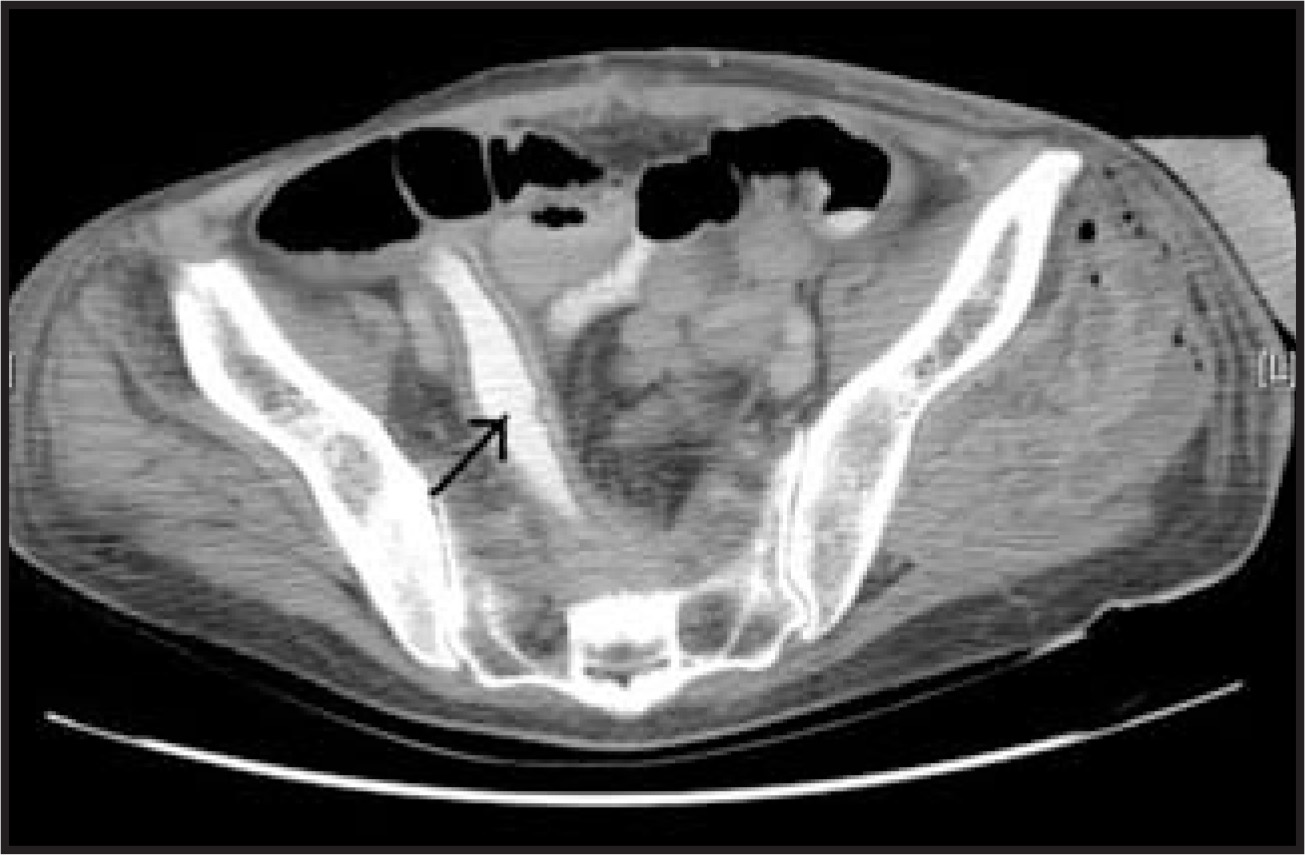 FIGURE 3.