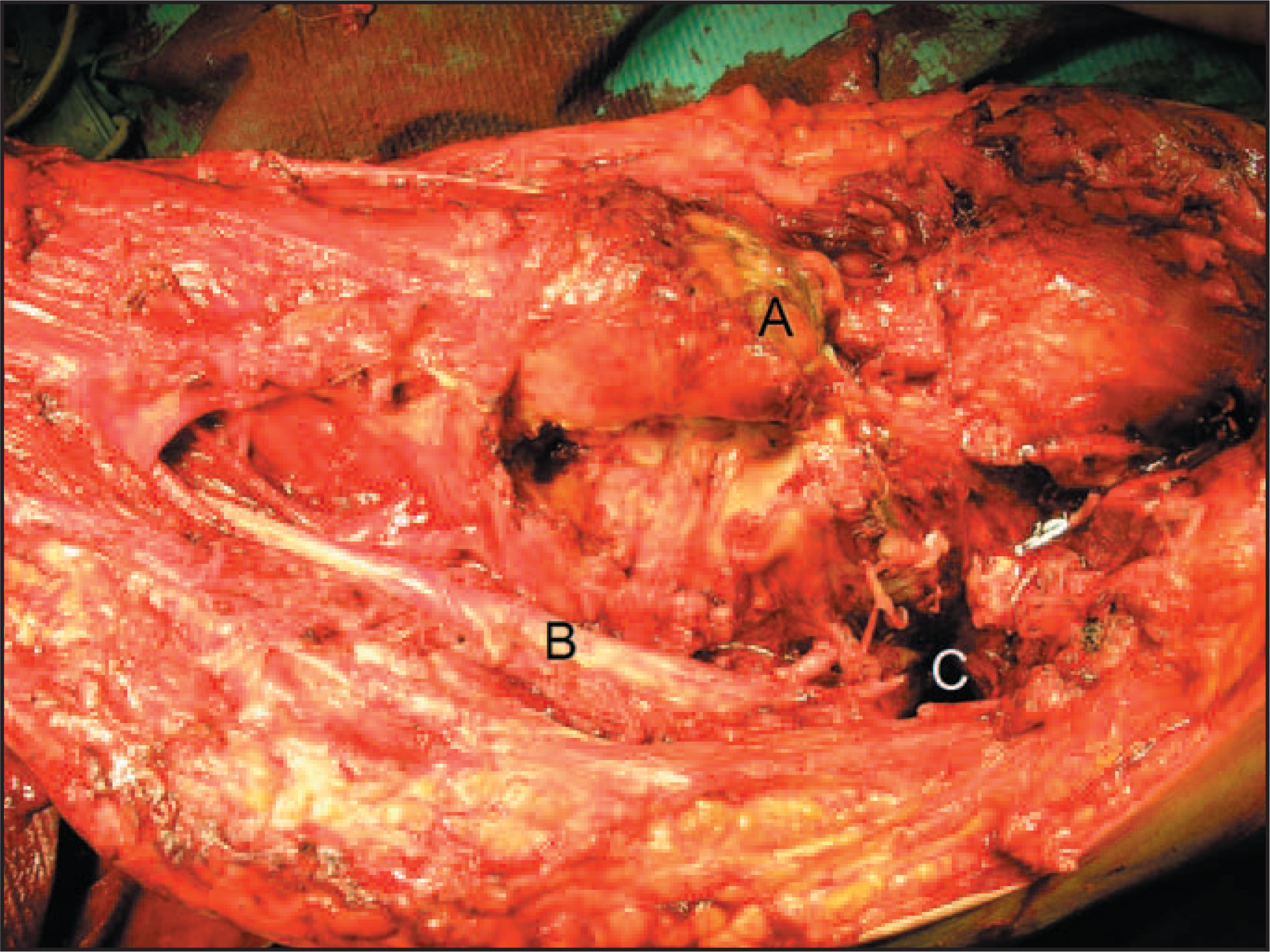 FIGURE 4.