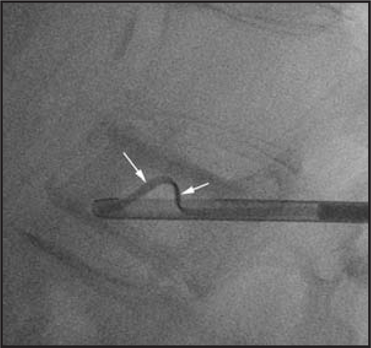 FIGURE 11.