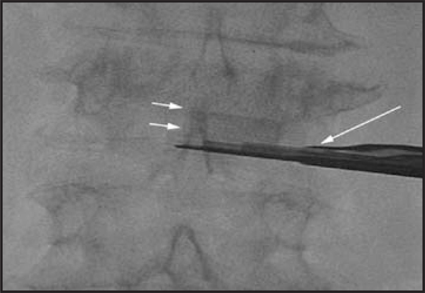 FIGURE 12.