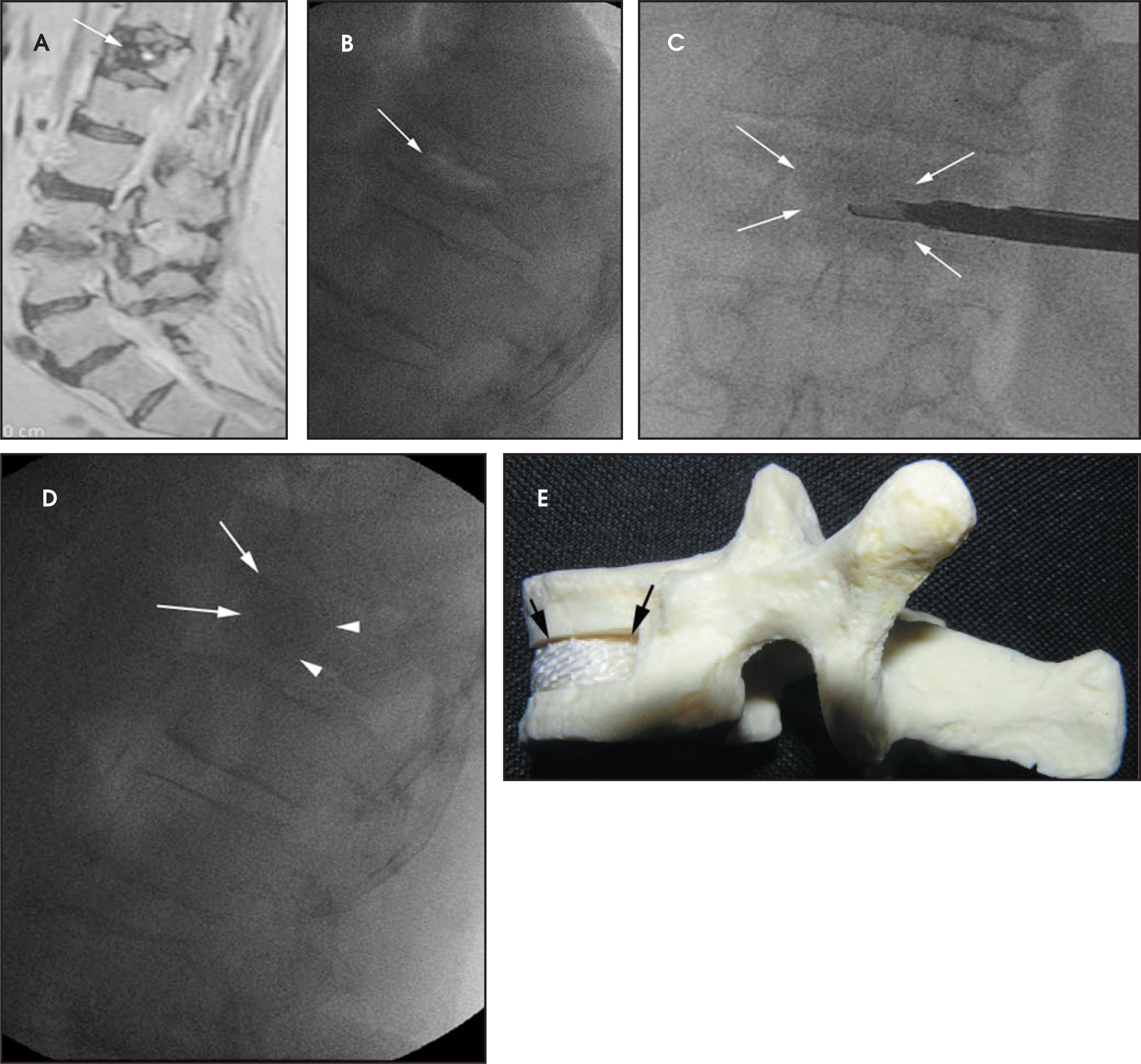 FIGURE 13.