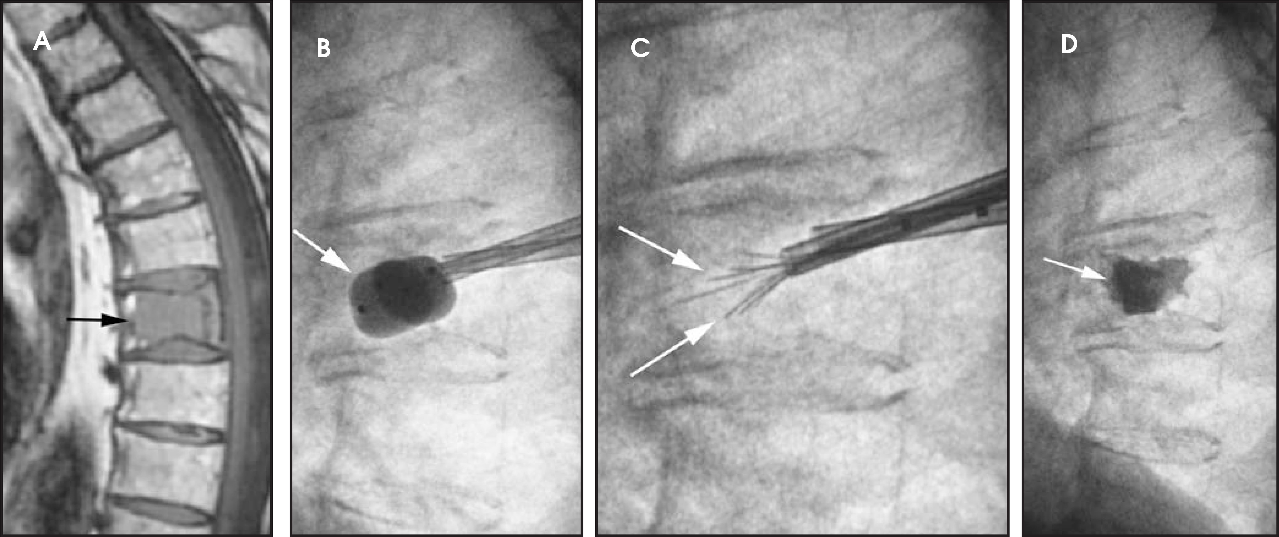 FIGURE 14.