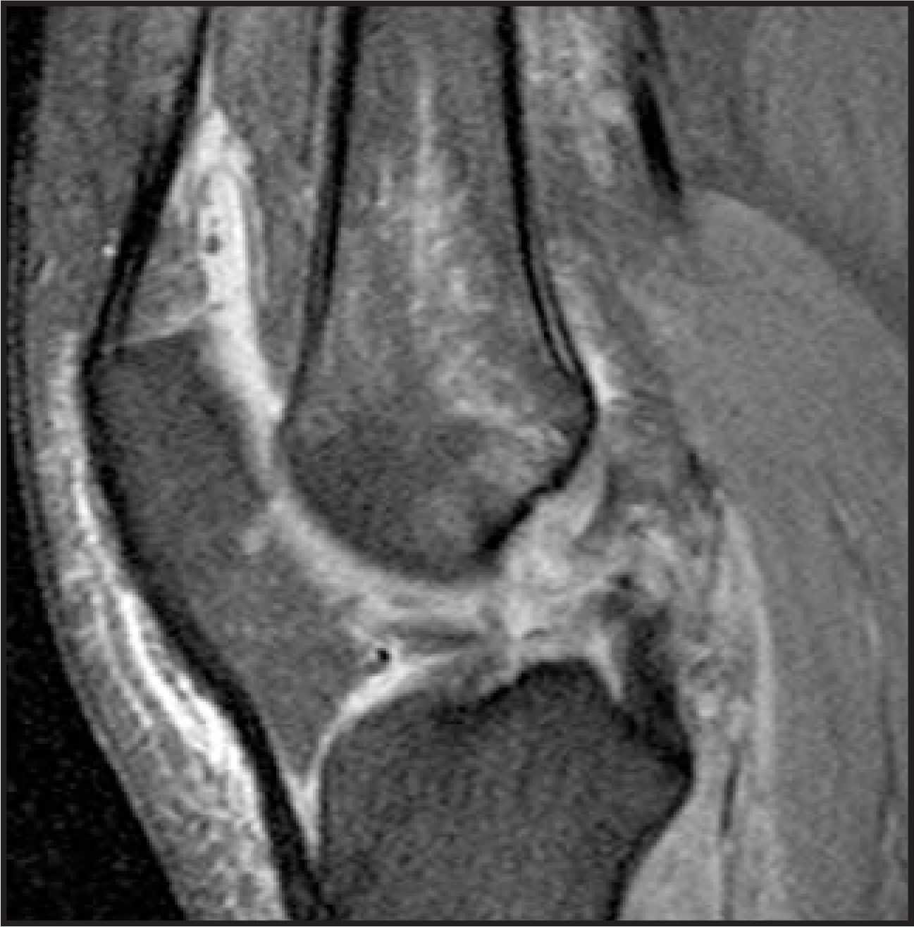 FIGURE 11.
