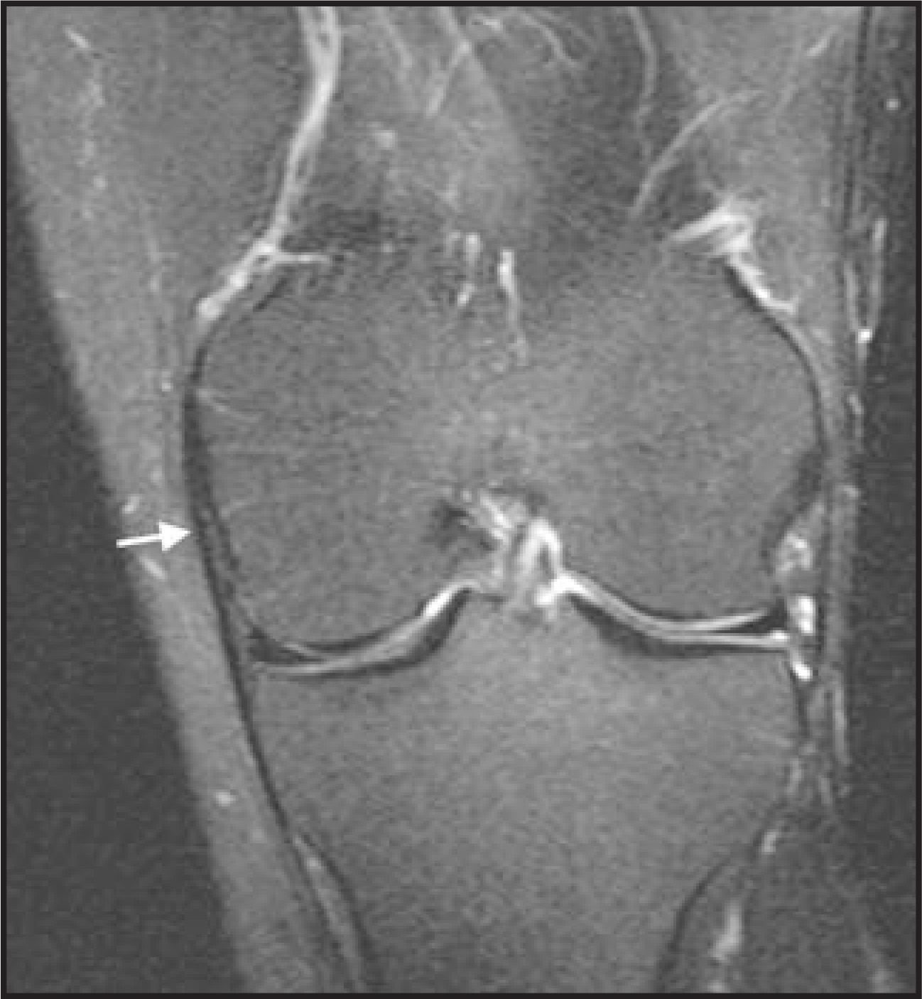 FIGURE 12.