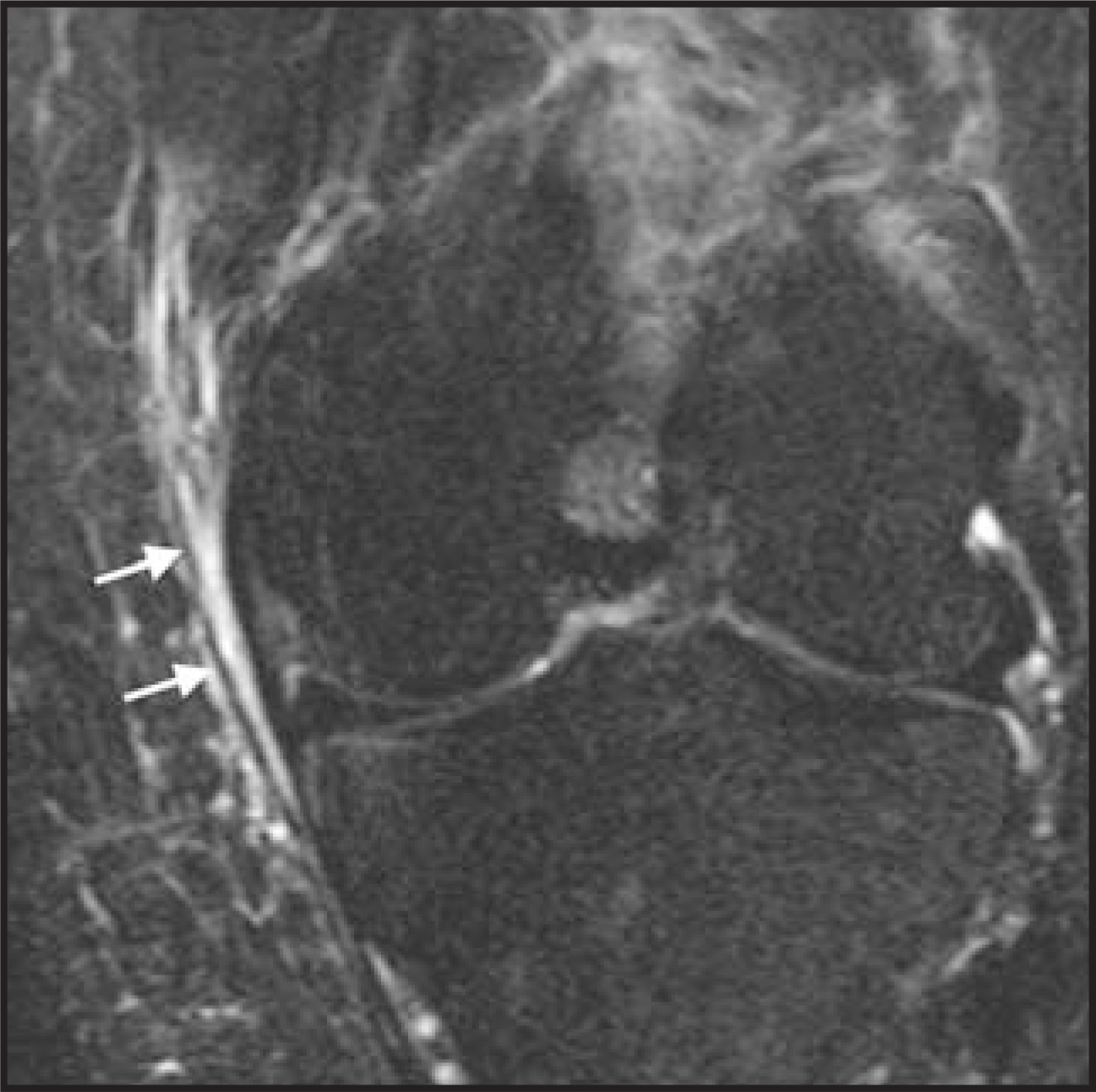 FIGURE 13.