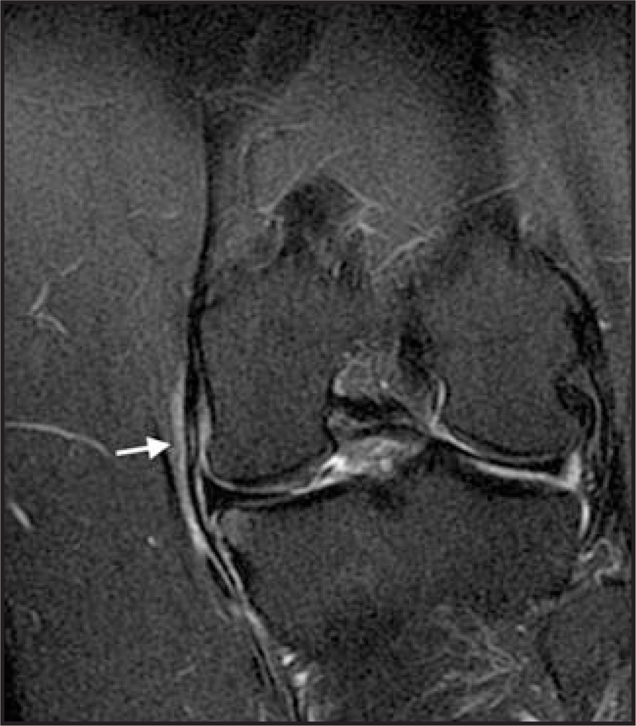 FIGURE 14.