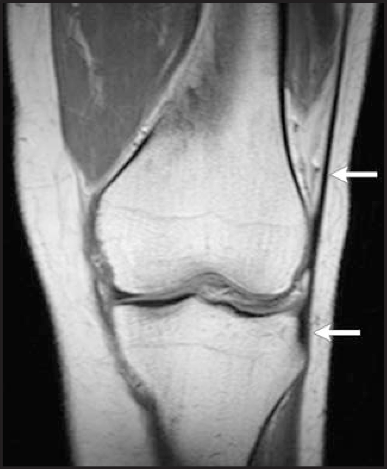 FIGURE 16.