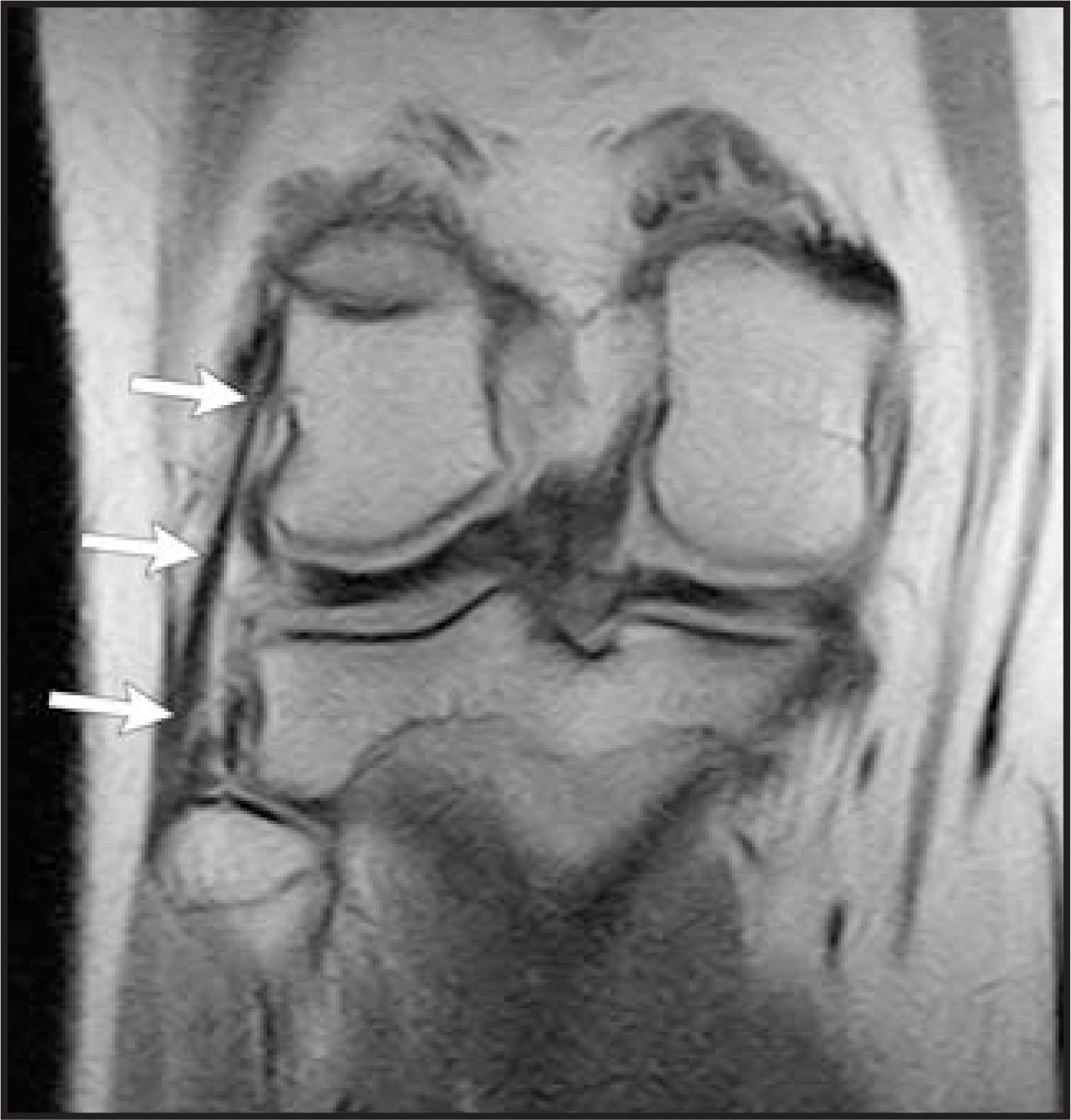 FIGURE 17.