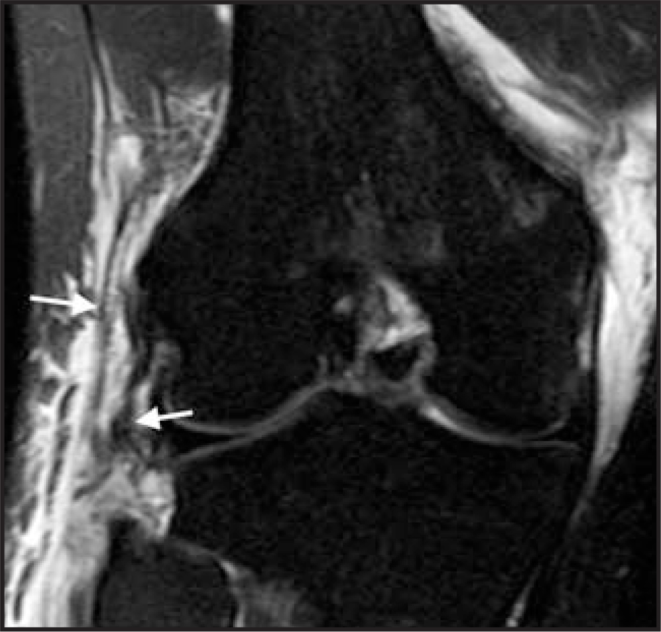 FIGURE 20.