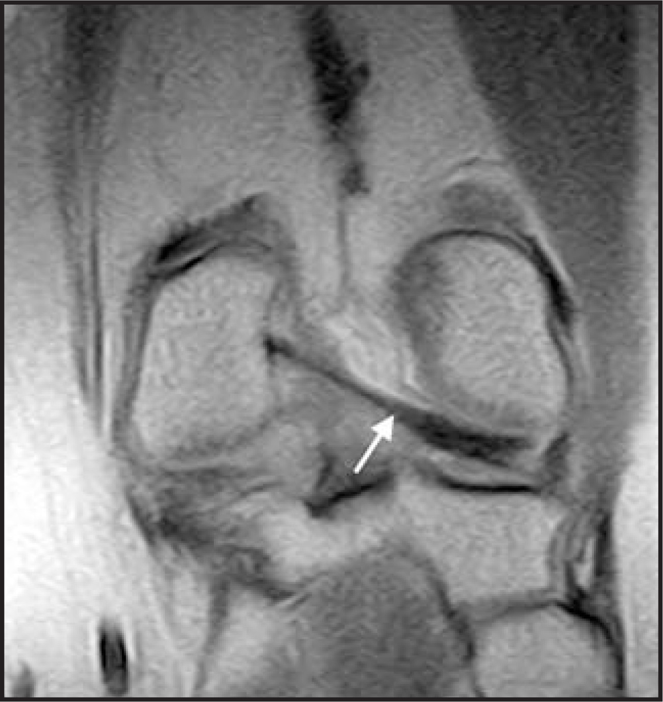 FIGURE 22.