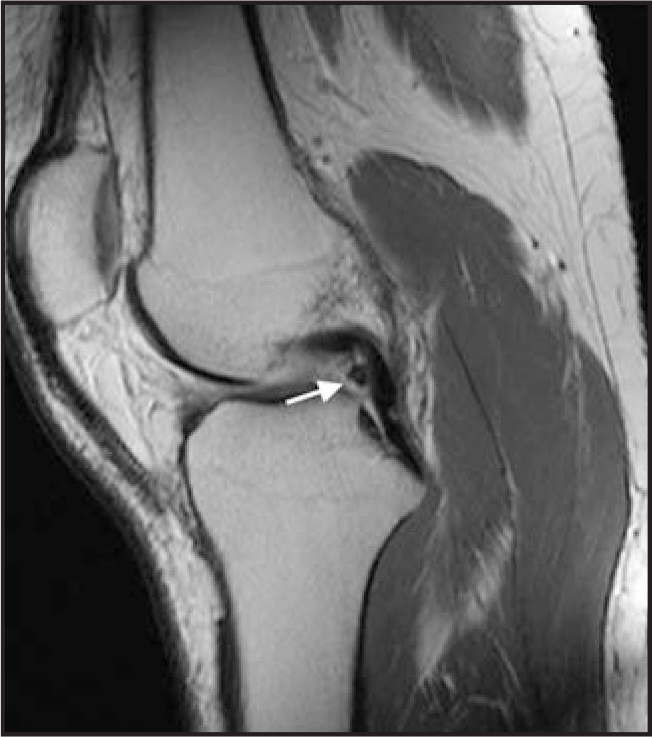 FIGURE 23.