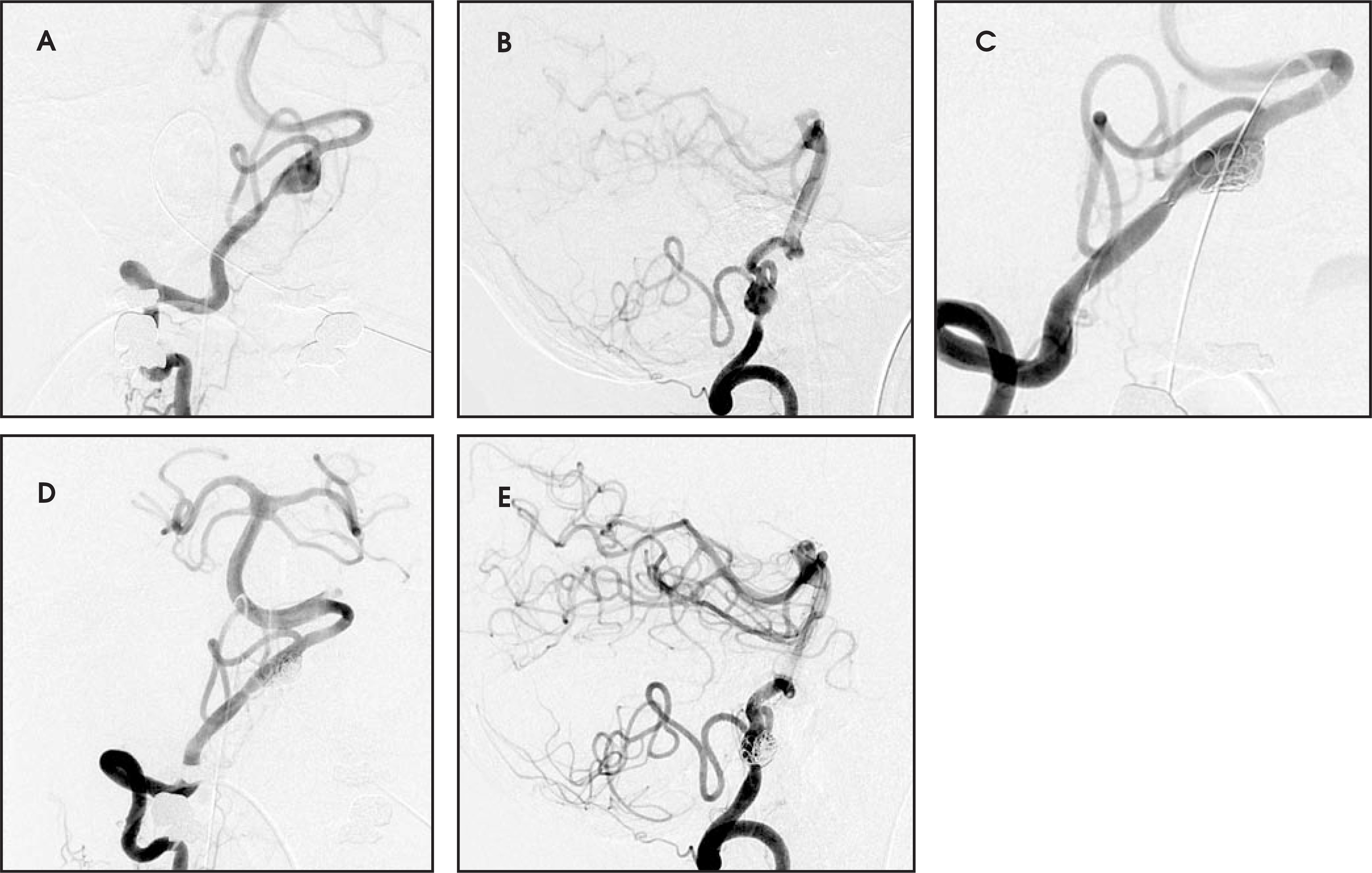 FIGURE 11.